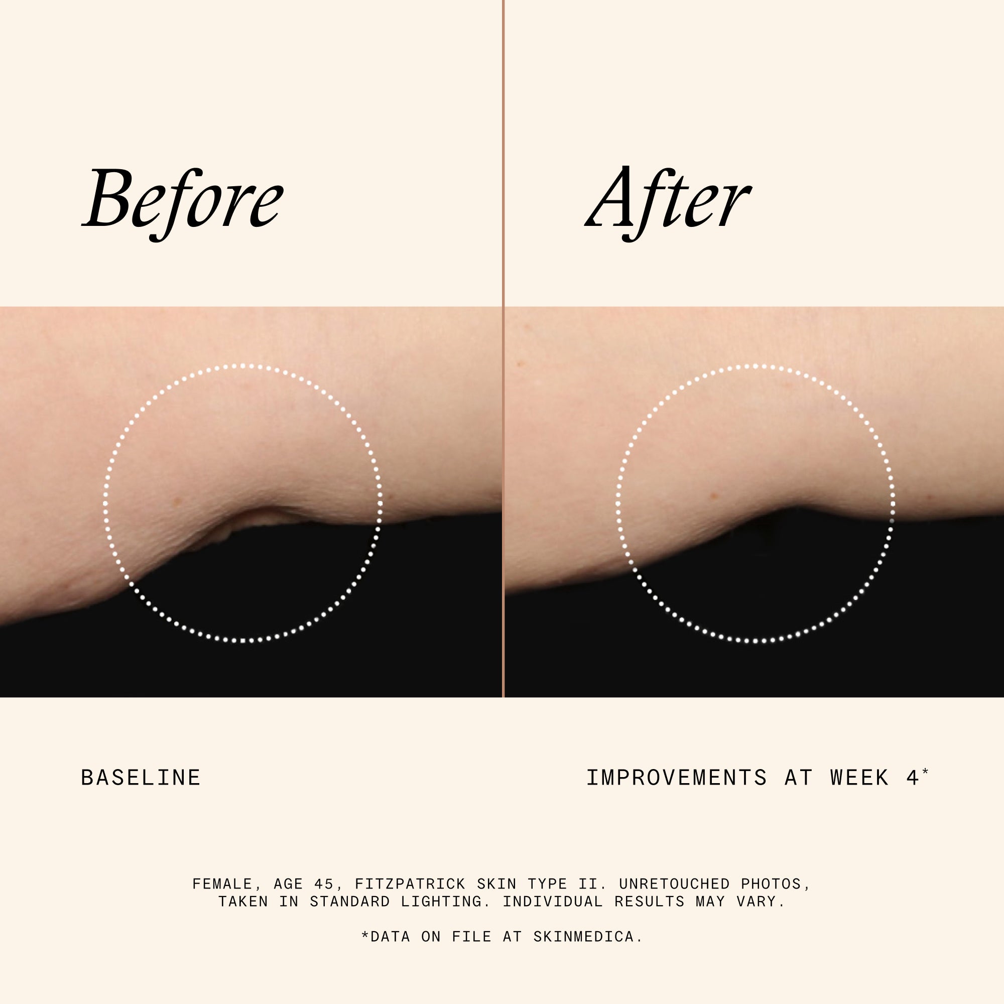 SkinMedica Firm & Tone Body Lotion (6 oz)