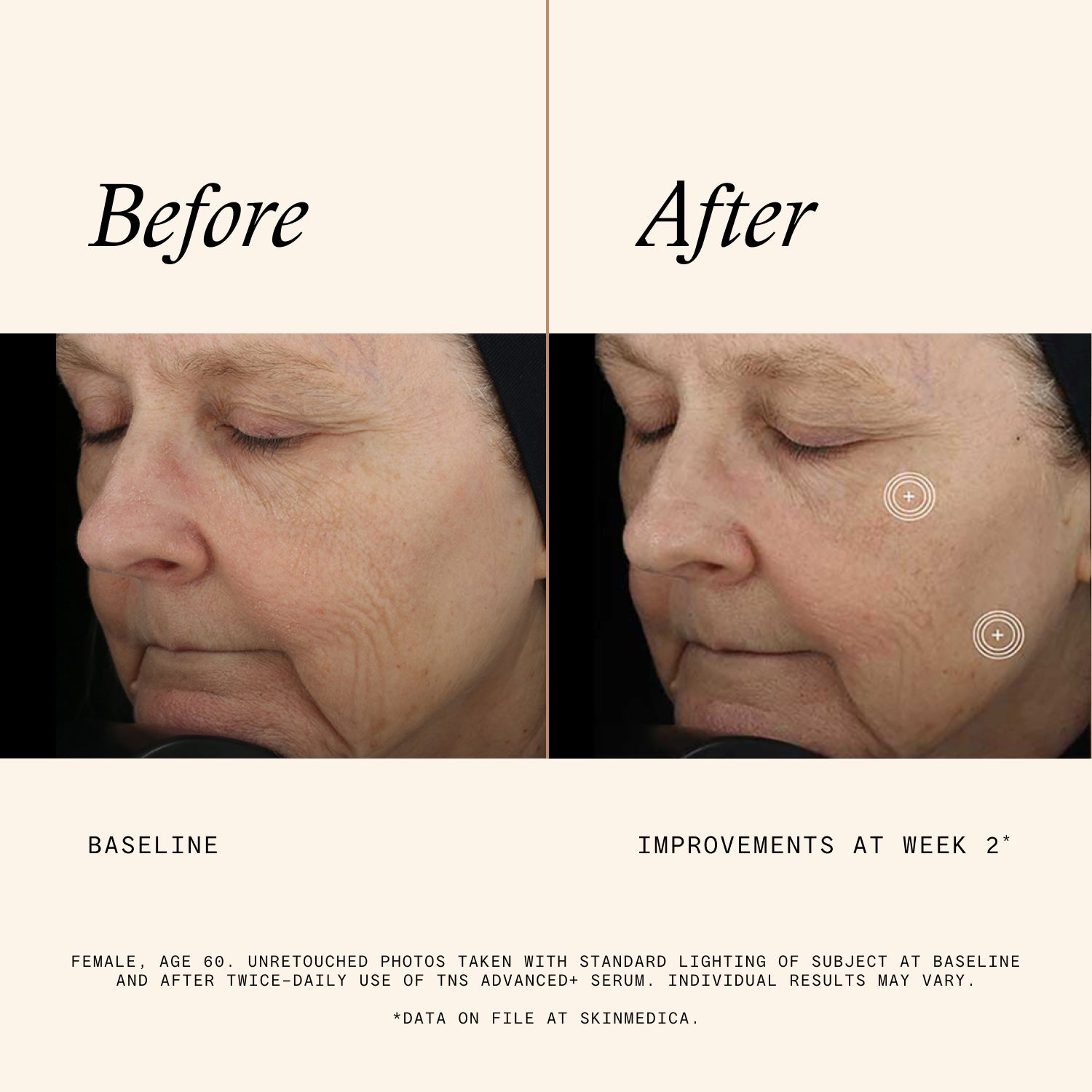 SkinMedica TNS Advanced+ Serum (1 oz) Buy 2 Get 1 Free