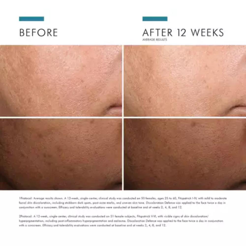 SkinCeuticals Discoloration Defense (1 oz)