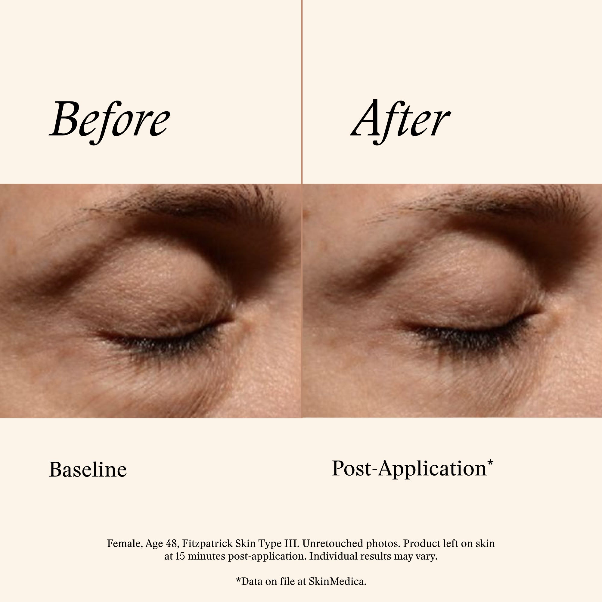 SkinMedica Instant Bright Eye Cream (0.5 oz)