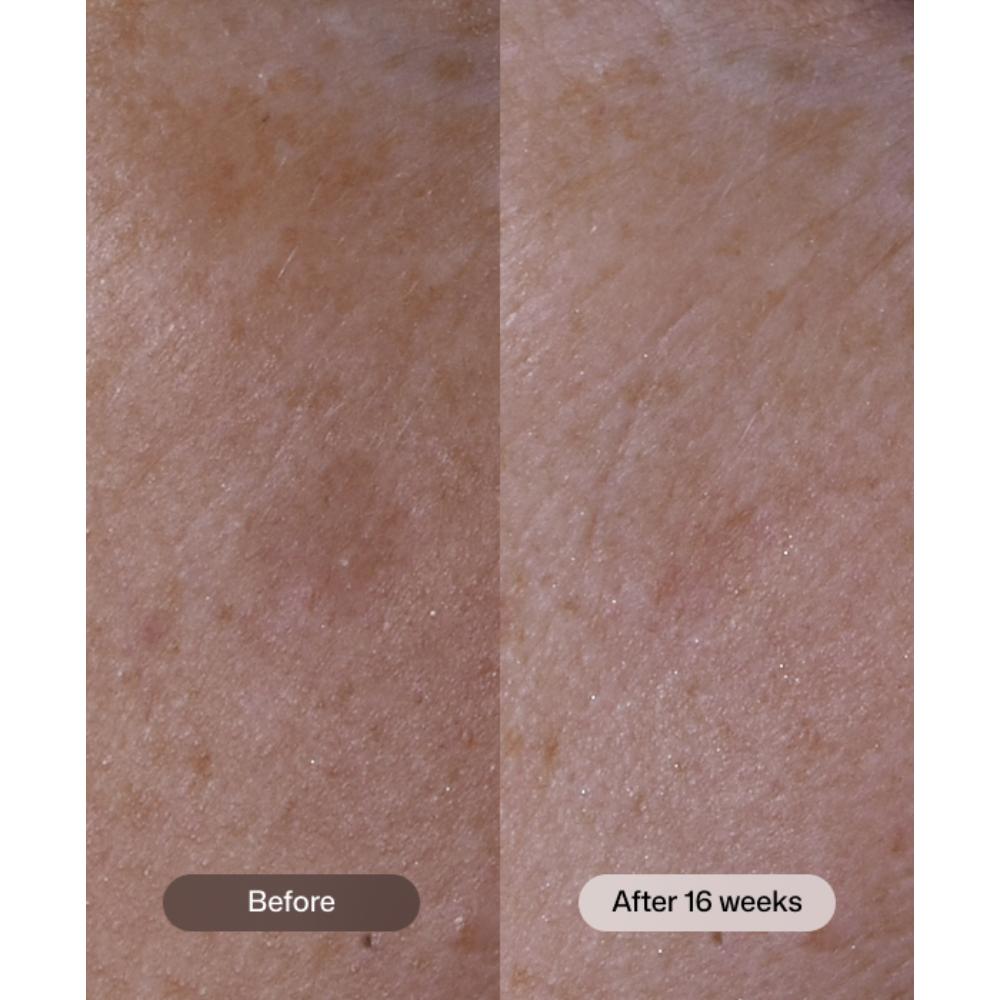Revision Skincare Advanced Pigment Corrector+ (1 oz)