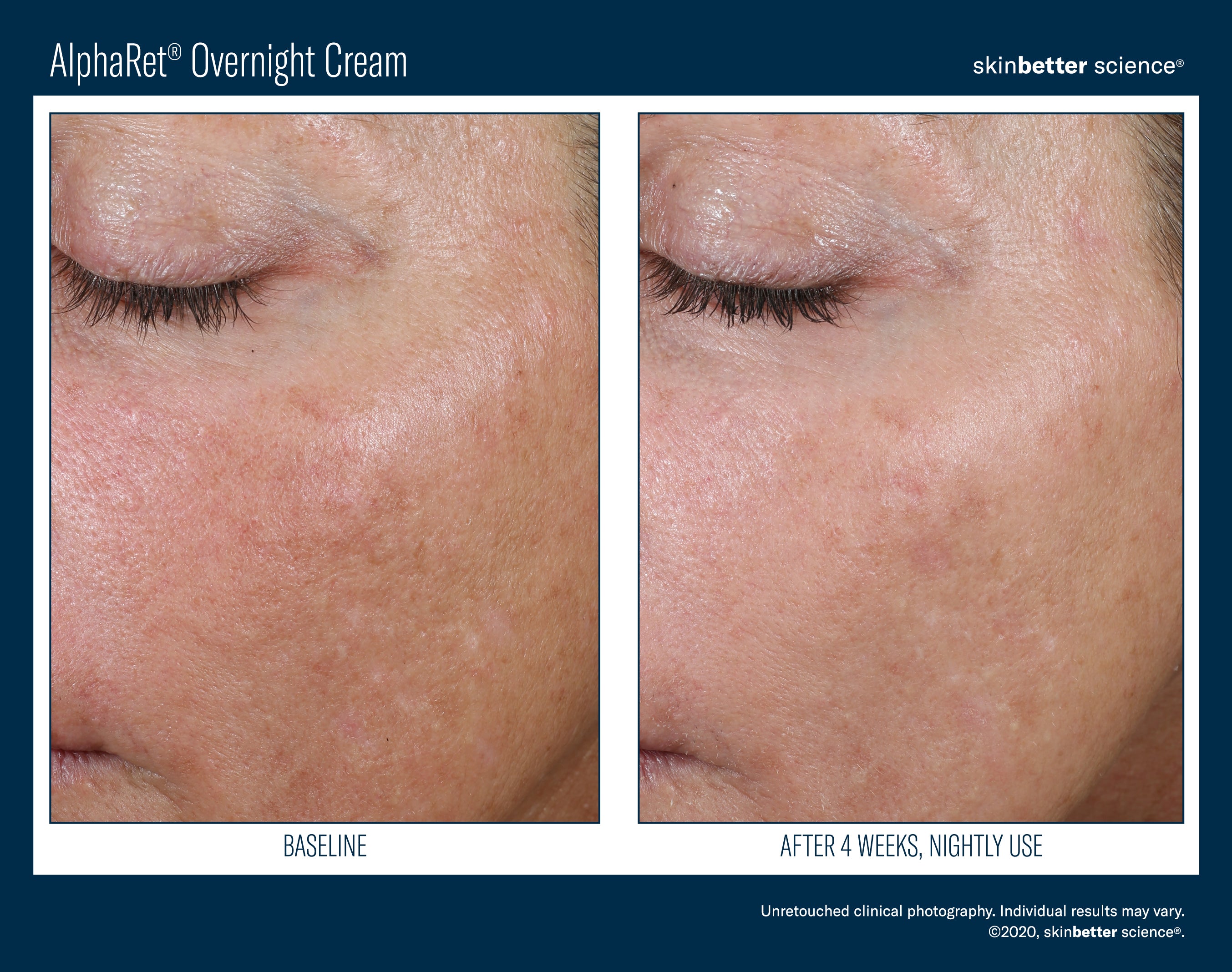 SkinBetter Science Travel Size AlphaRet Overnight Cream (0.5 oz)