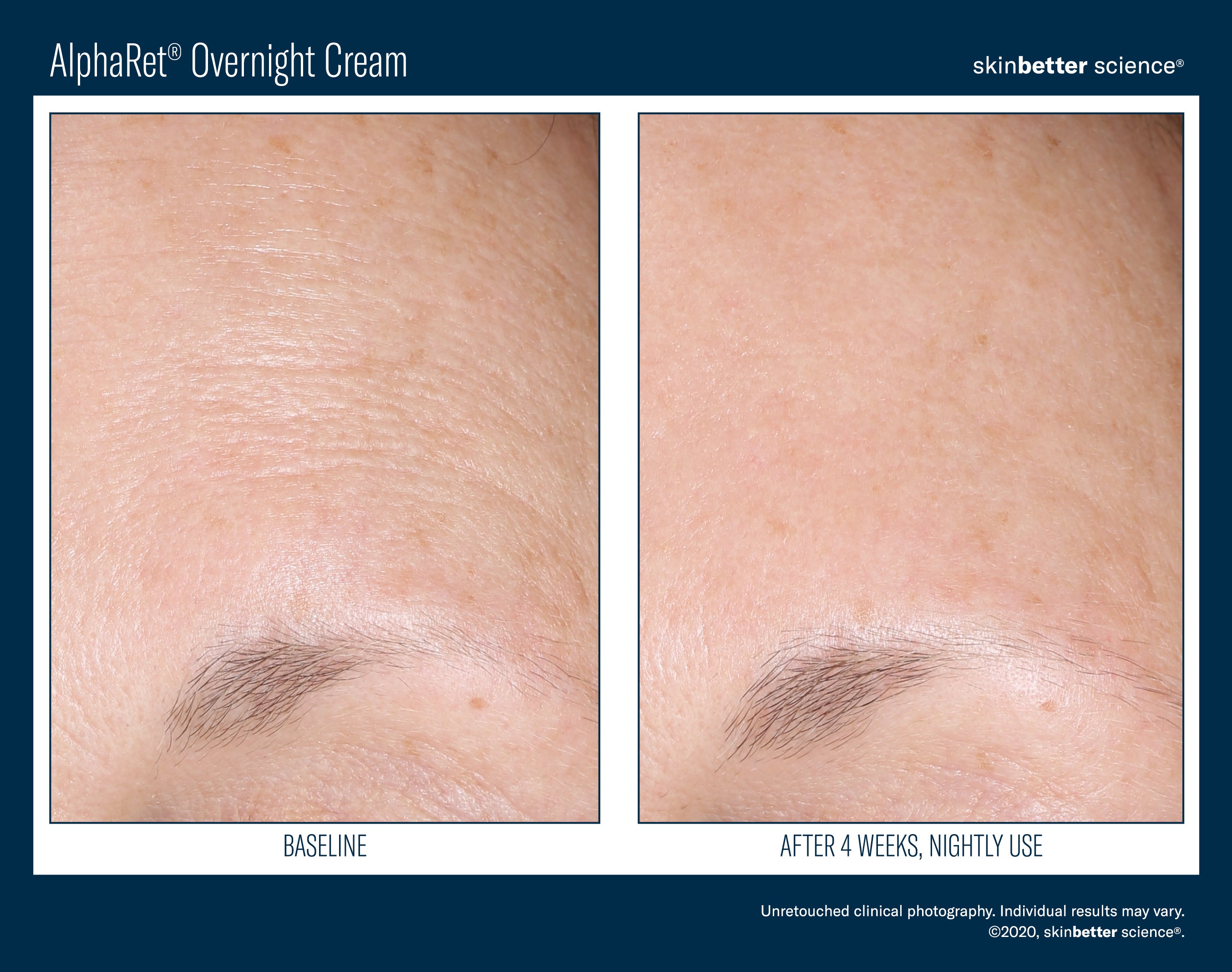 SkinBetter Science Travel Size AlphaRet Overnight Cream (0.5 oz)