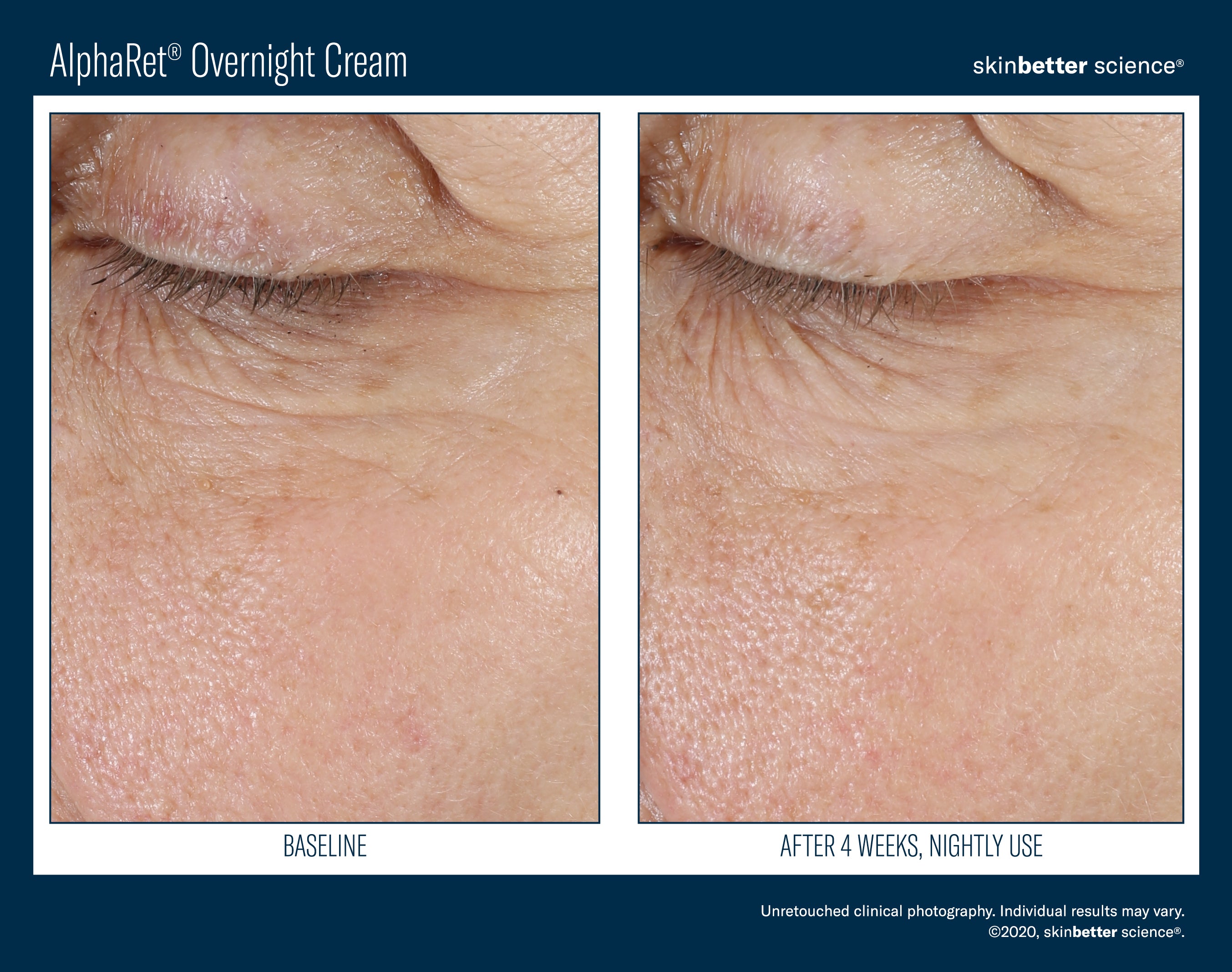 SkinBetter Science Travel Size AlphaRet Overnight Cream (0.5 oz)