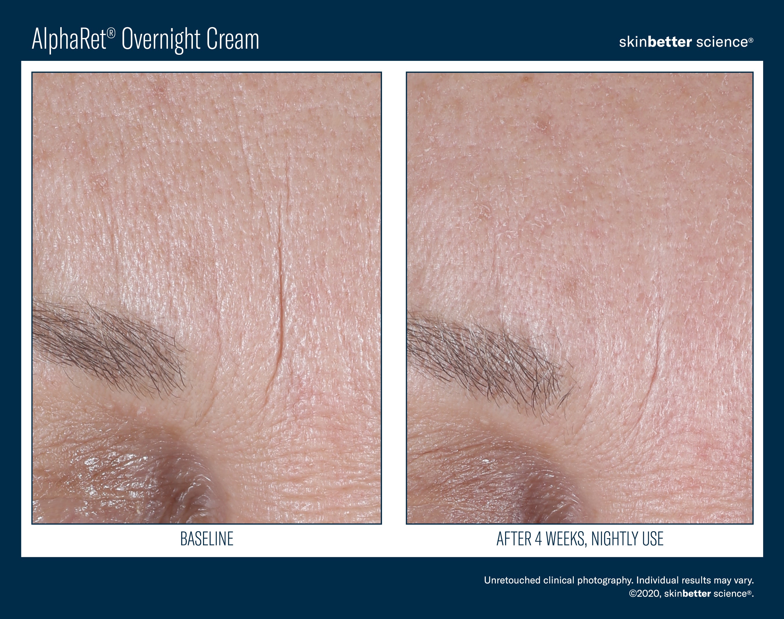 SkinBetter Science Travel Size AlphaRet Overnight Cream (0.5 oz)