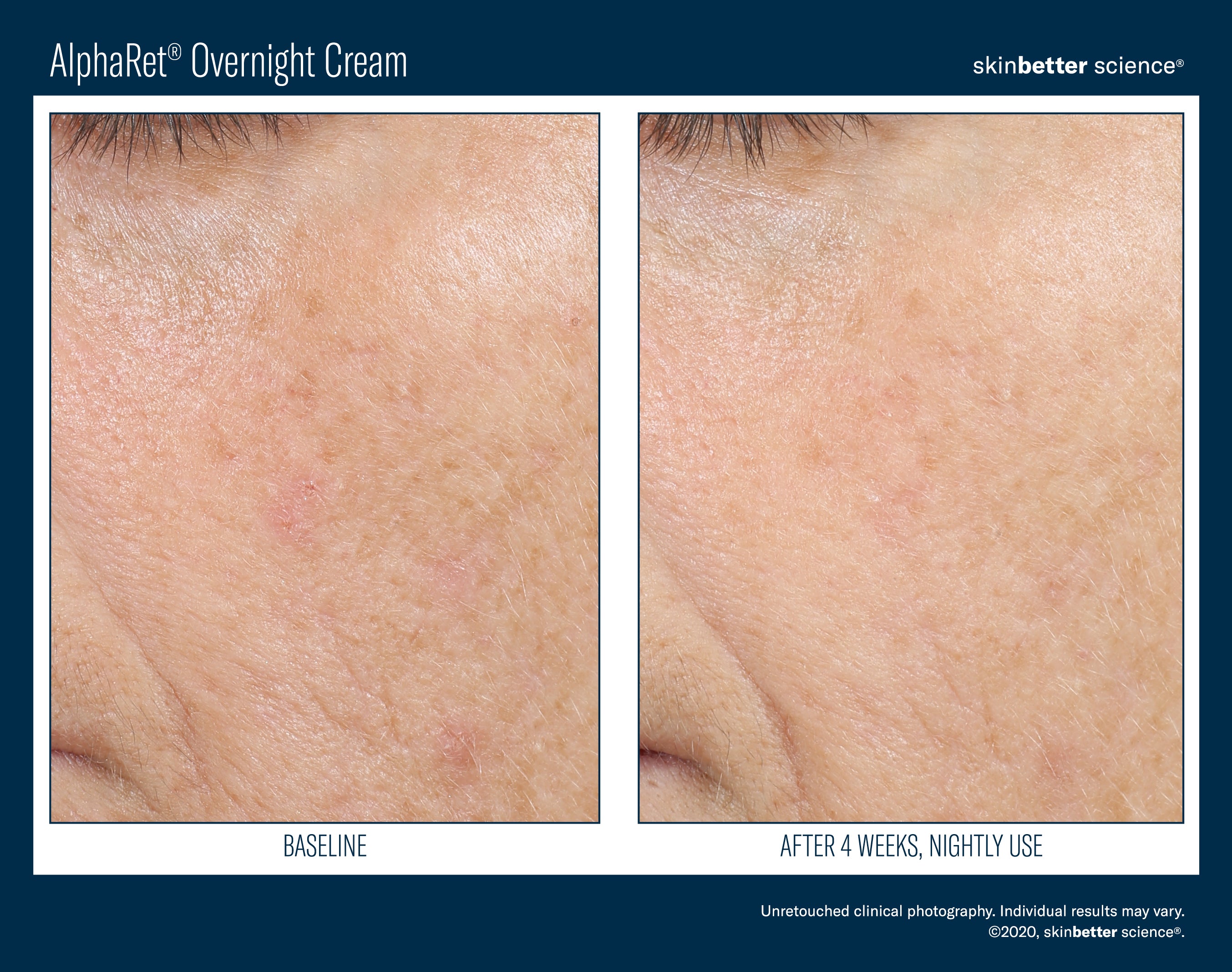 SkinBetter Science AlphaRet Overnight Cream (1.69 oz)