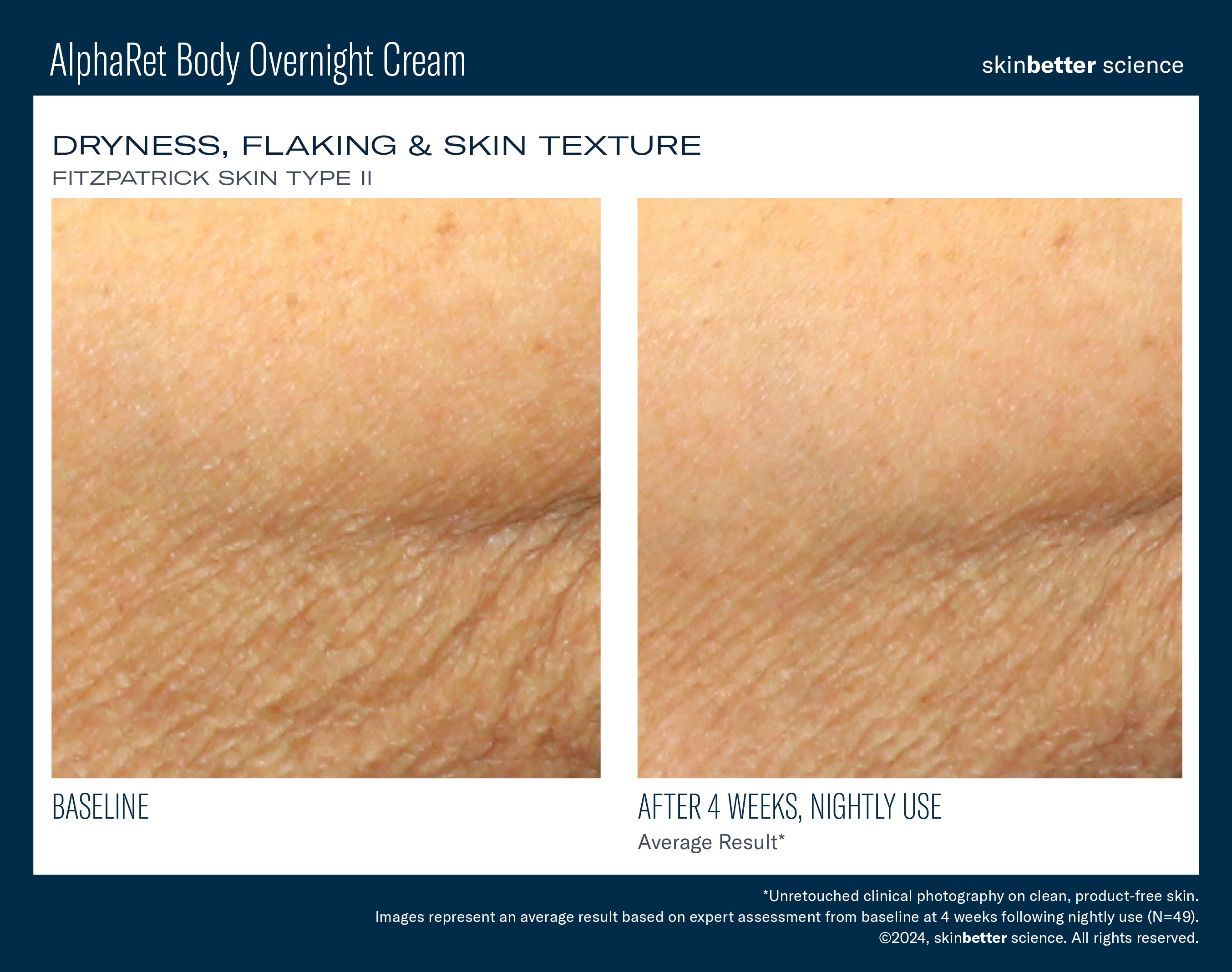 SkinBetter Science AlphaRet Body Overnight Cream (5 oz)