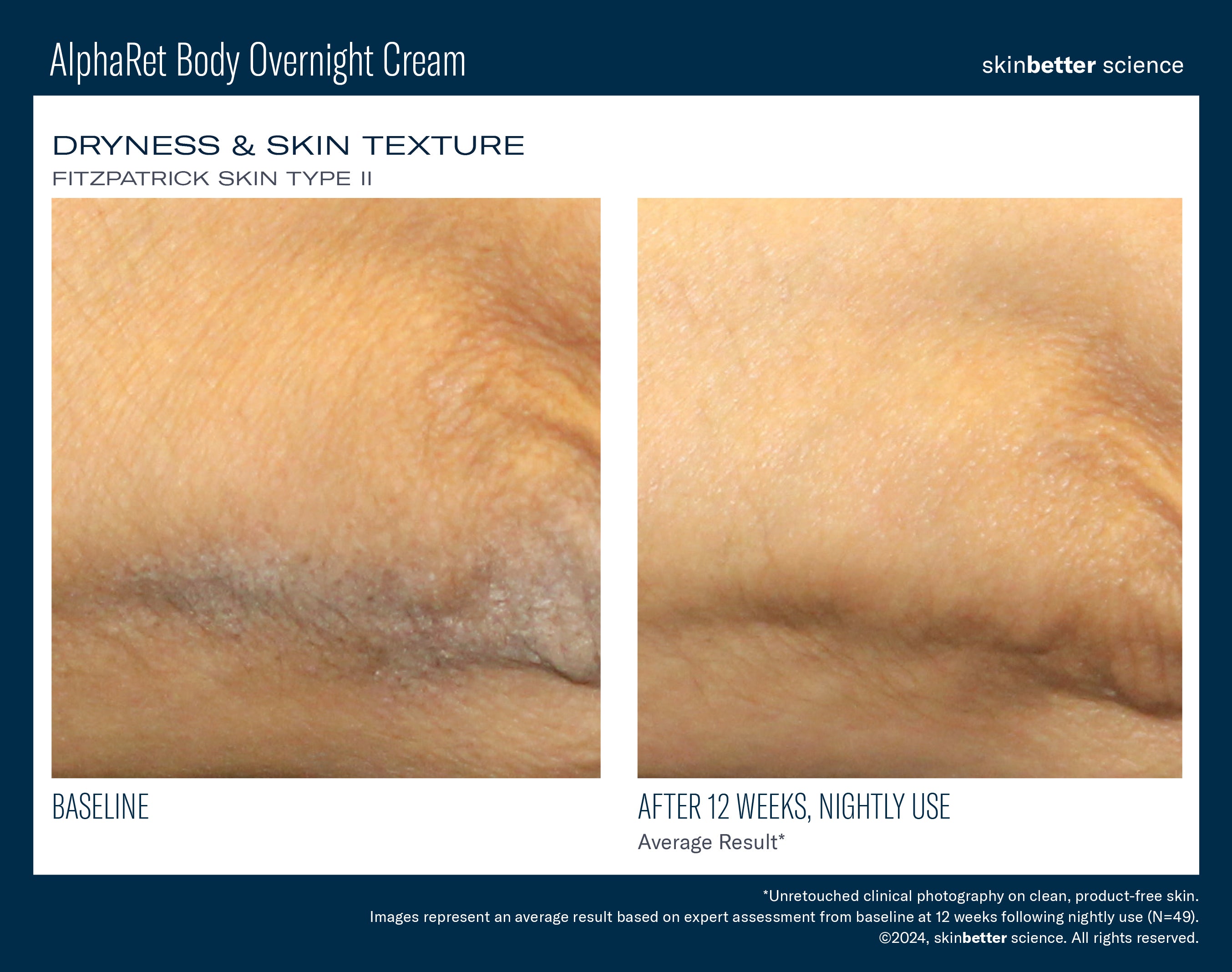 SkinBetter Science Travel Size AlphaRet Body Overnight Cream (0.5 oz)