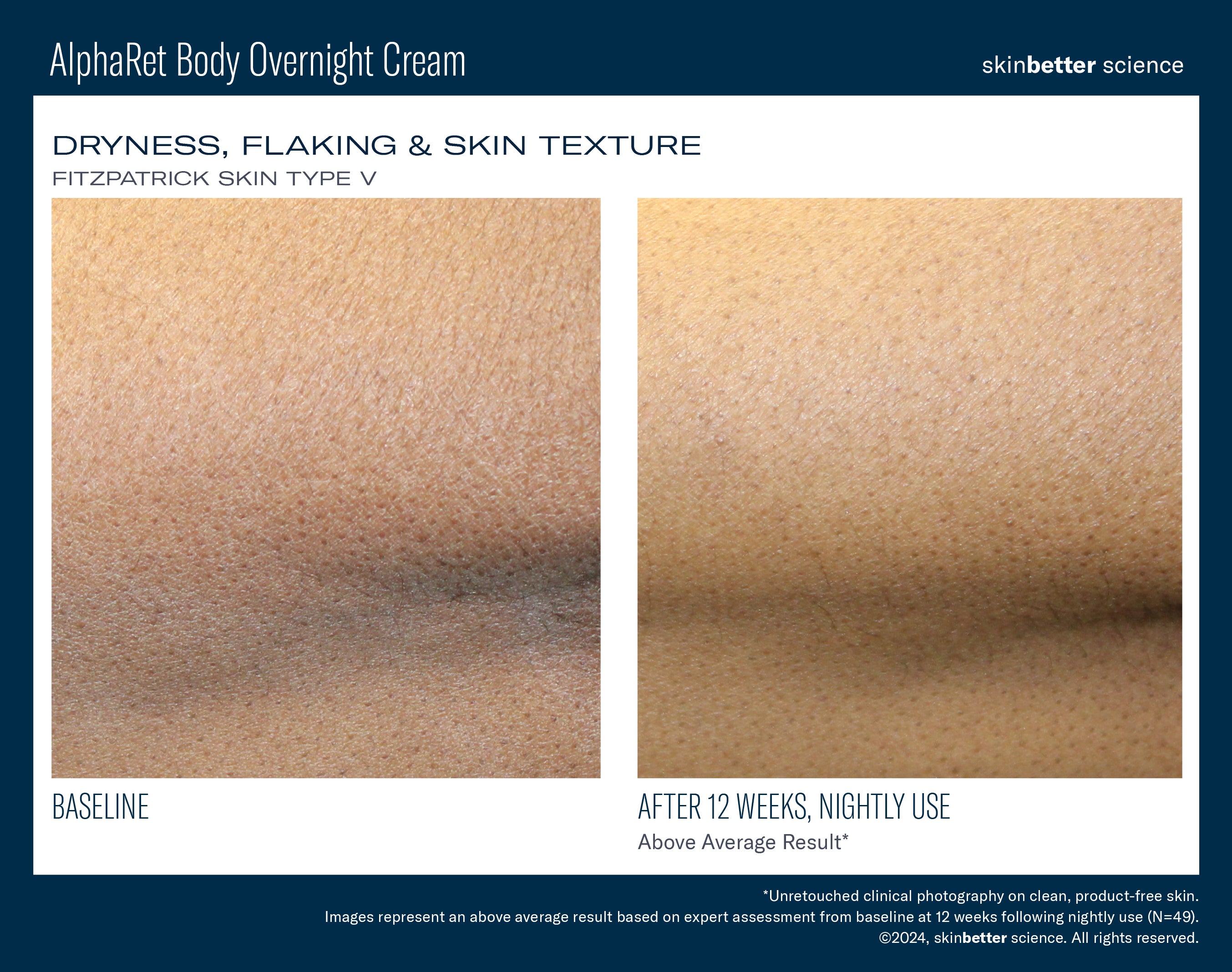 SkinBetter Science Travel Size AlphaRet Body Overnight Cream (0.5 oz)