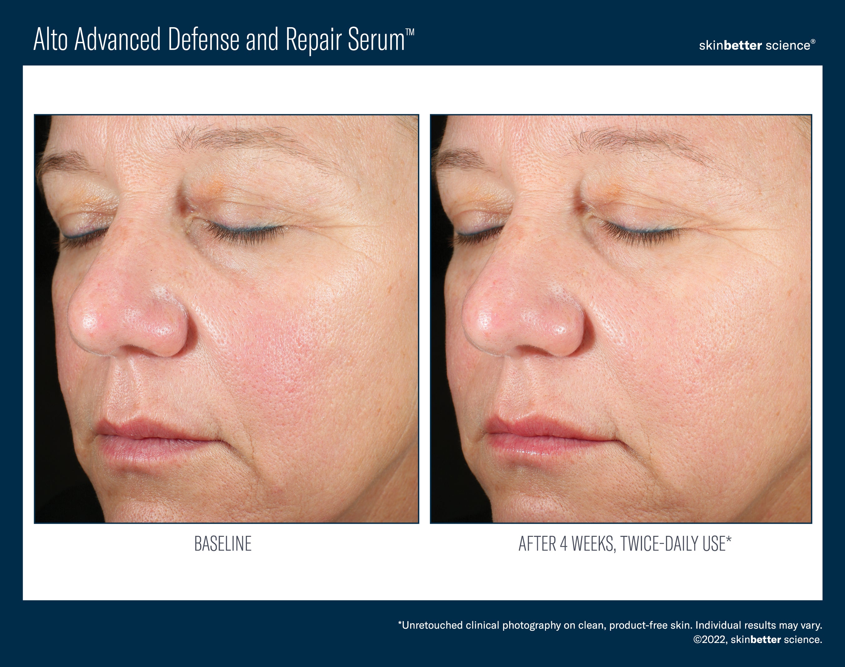SkinBetter Science Travel Size Alto Advanced Defense and Repair Serum (0.5 oz).