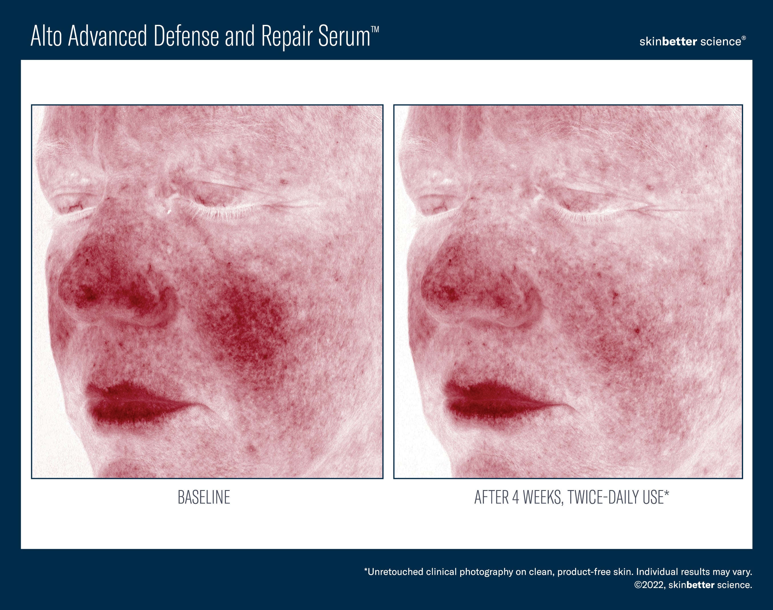 SkinBetter Science Travel Size Alto Advanced Defense and Repair Serum (0.5 oz).