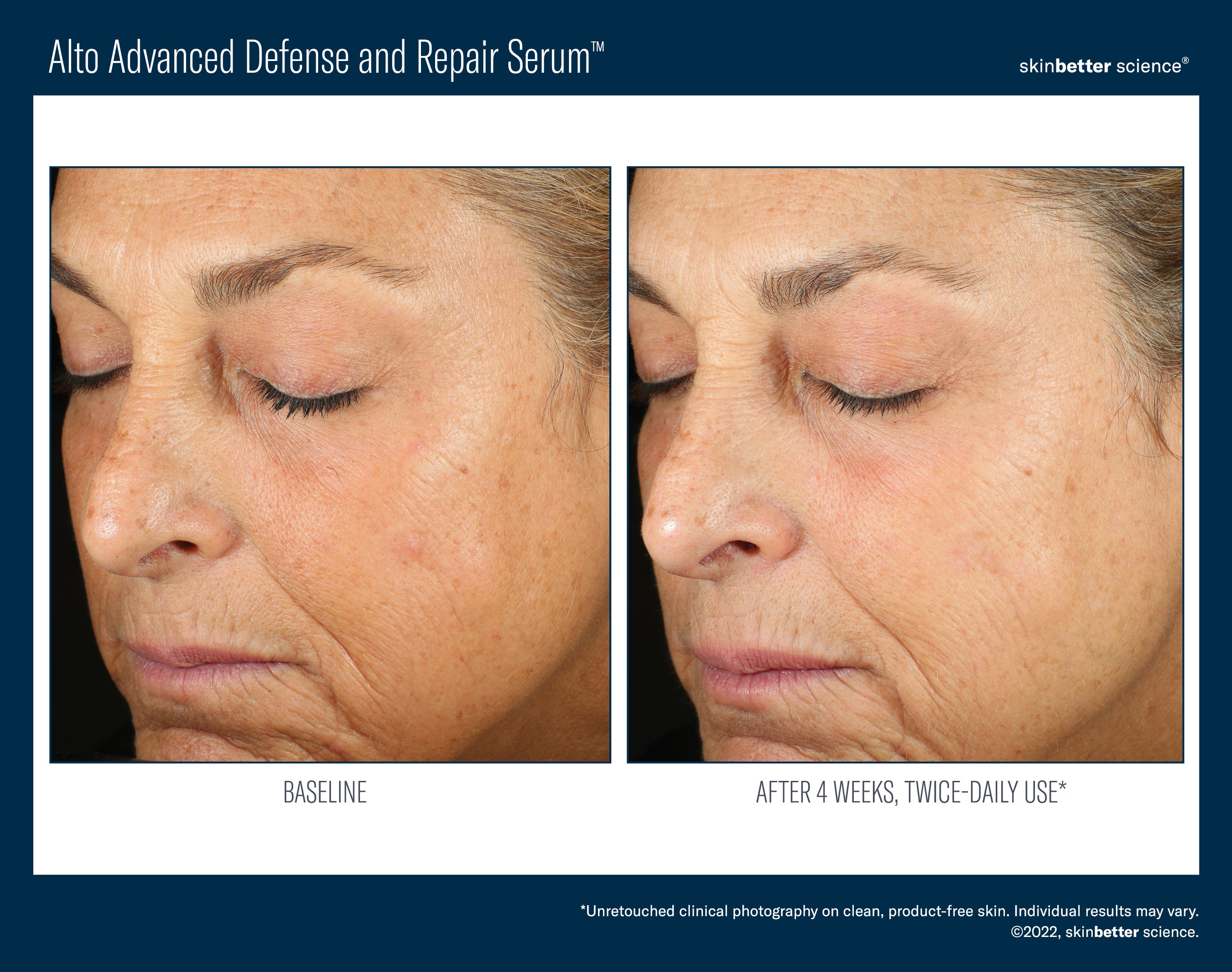 SkinBetter Science Travel Size Alto Advanced Defense and Repair Serum (0.5 oz).