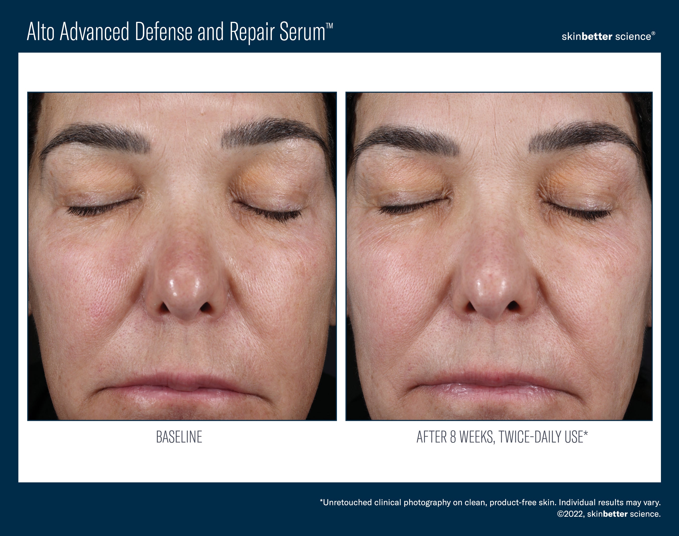 SkinBetter Science Travel Size Alto Advanced Defense and Repair Serum (0.5 oz).