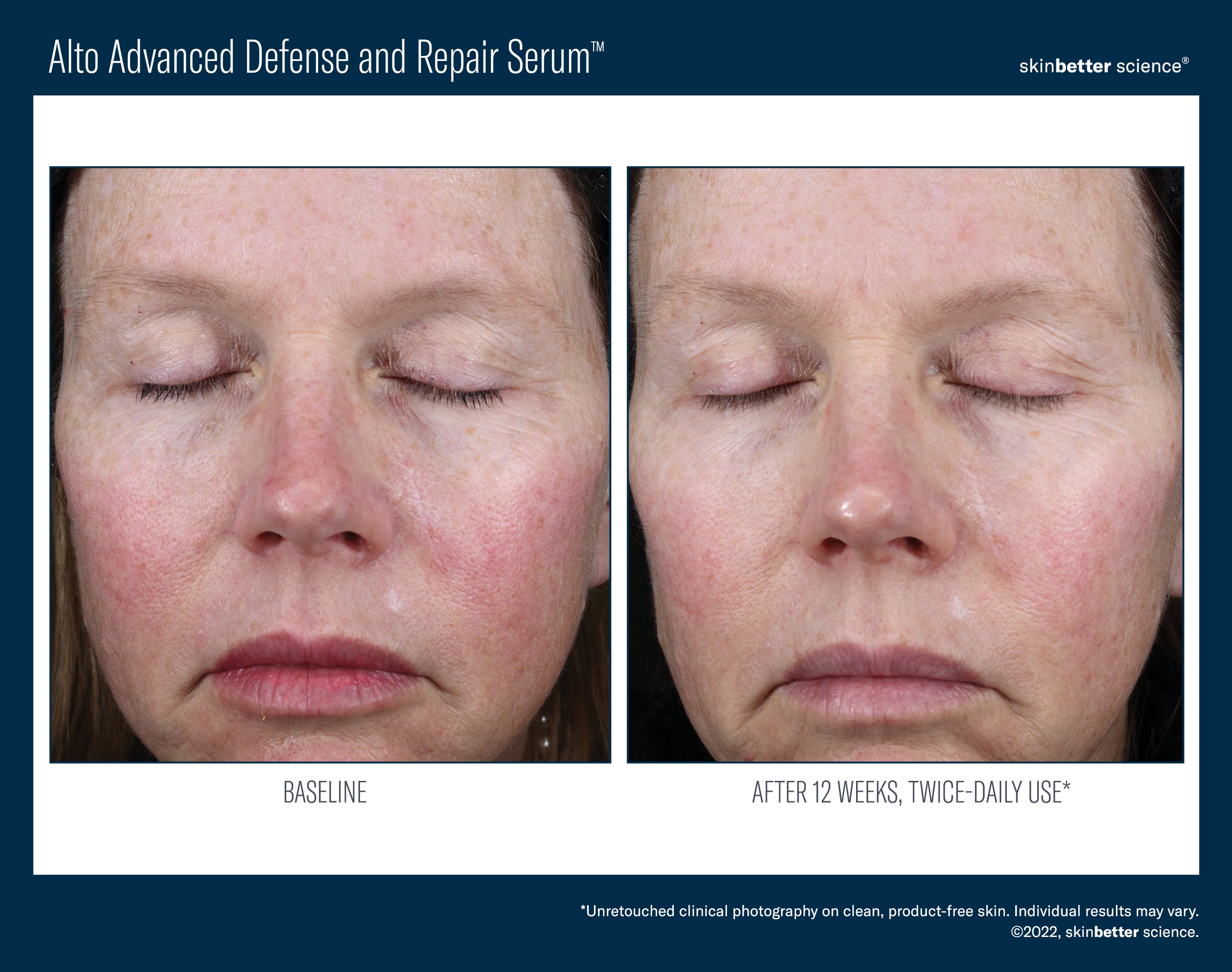 SkinBetter Science Travel Size Alto Advanced Defense and Repair Serum (0.5 oz).