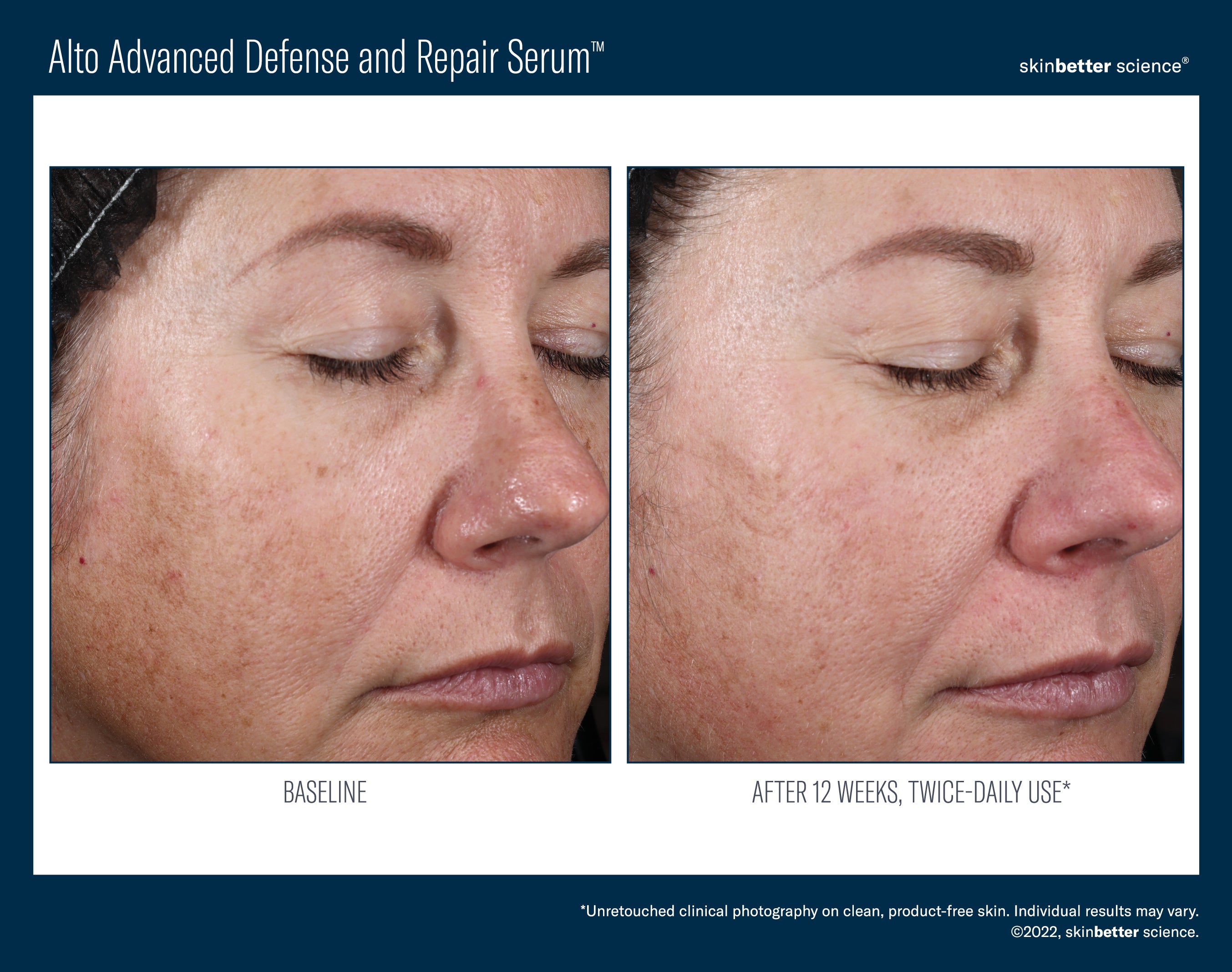 SkinBetter Science Travel Size Alto Advanced Defense and Repair Serum (0.5 oz).