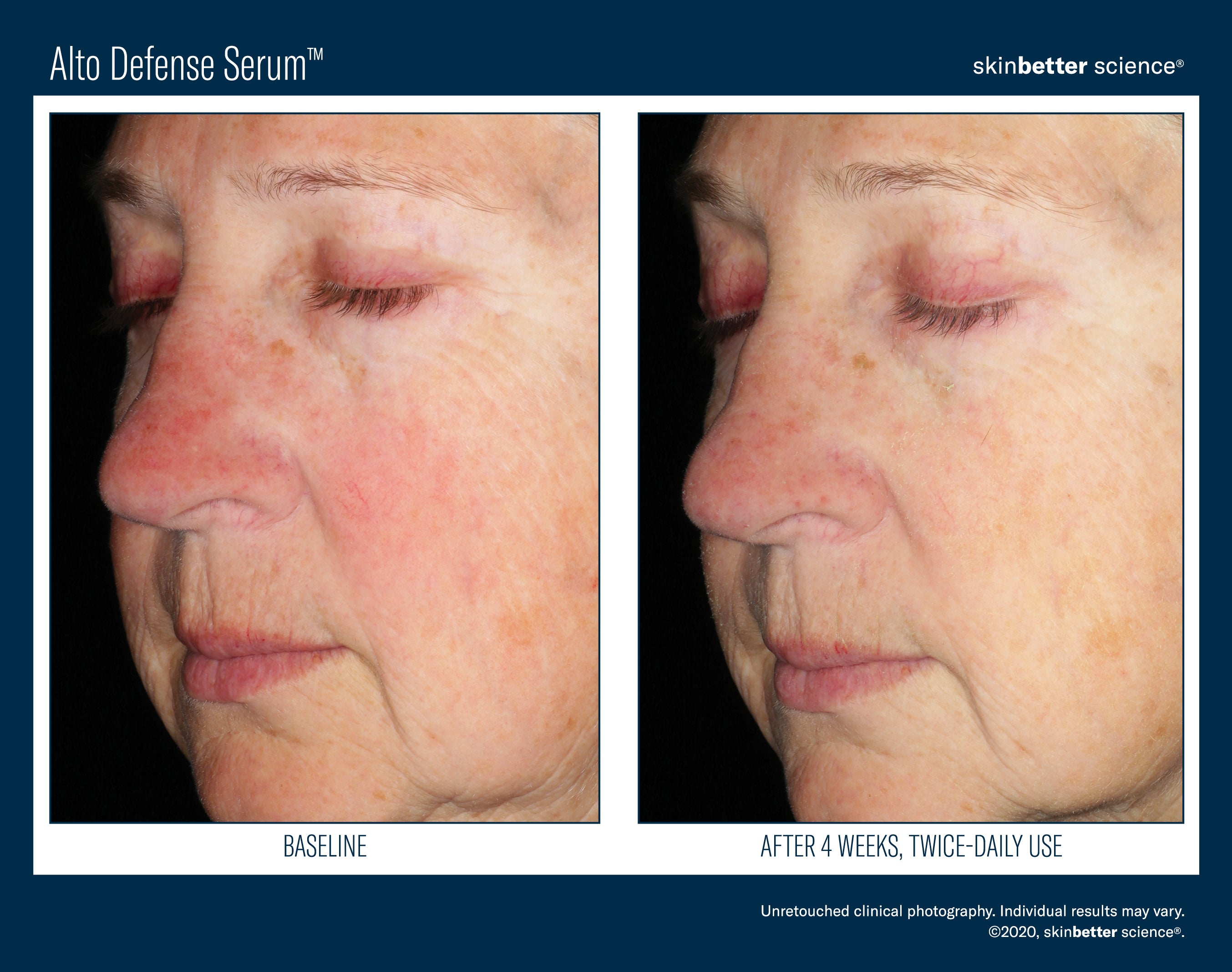 SkinBetter Science Alto Defense Serum (1 oz)