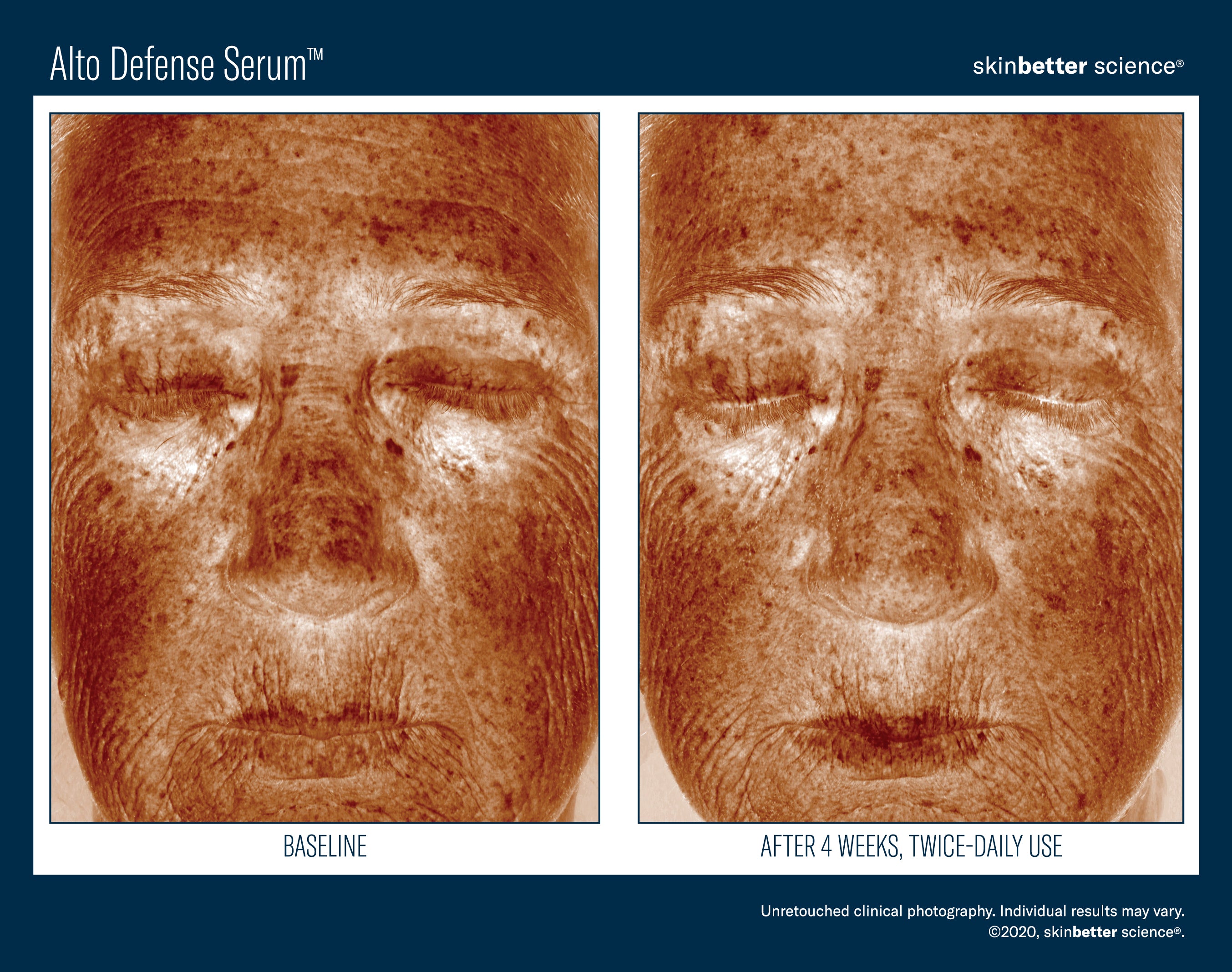 SkinBetter Science Alto Defense Serum (1.69 oz)