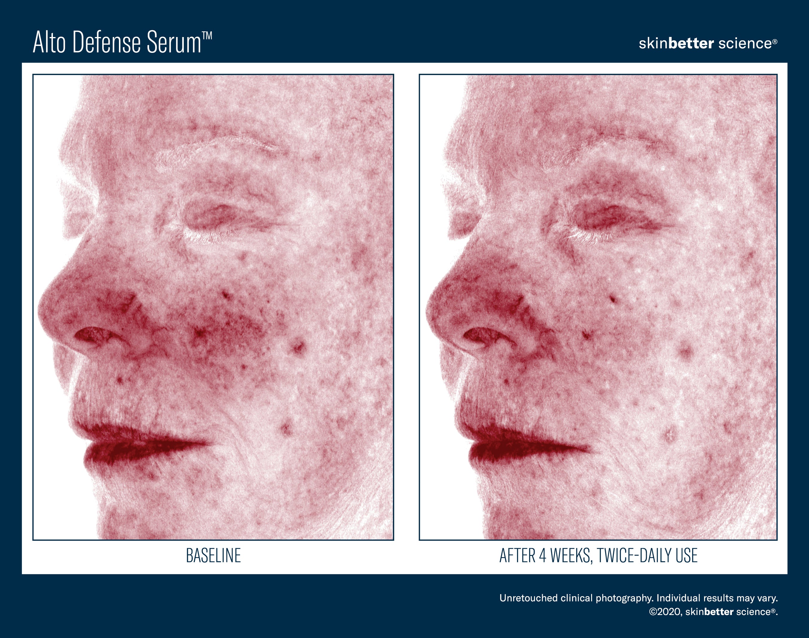SkinBetter Science Alto Defense Serum (1 oz)