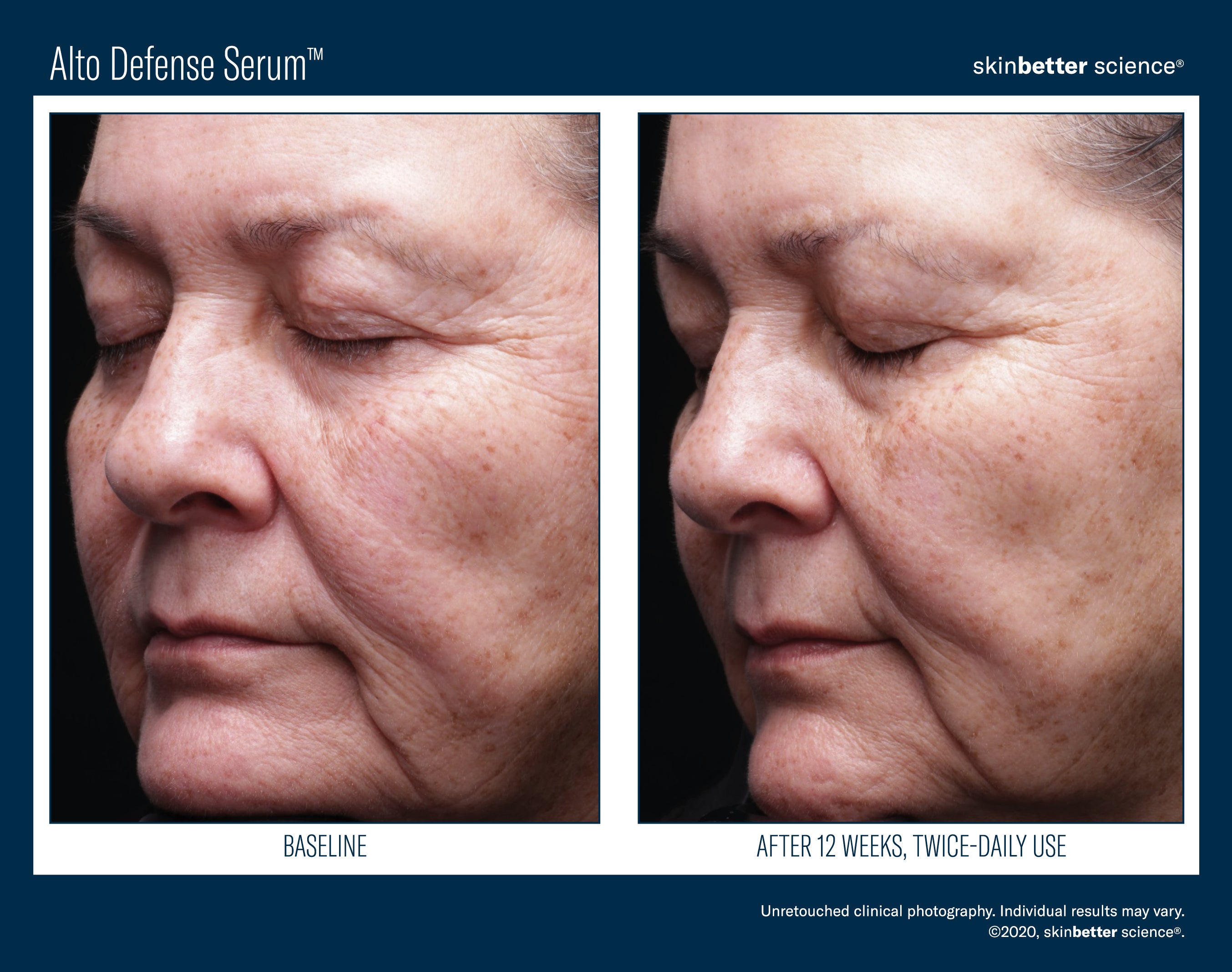 SkinBetter Science Alto Defense Serum (1.69 oz)