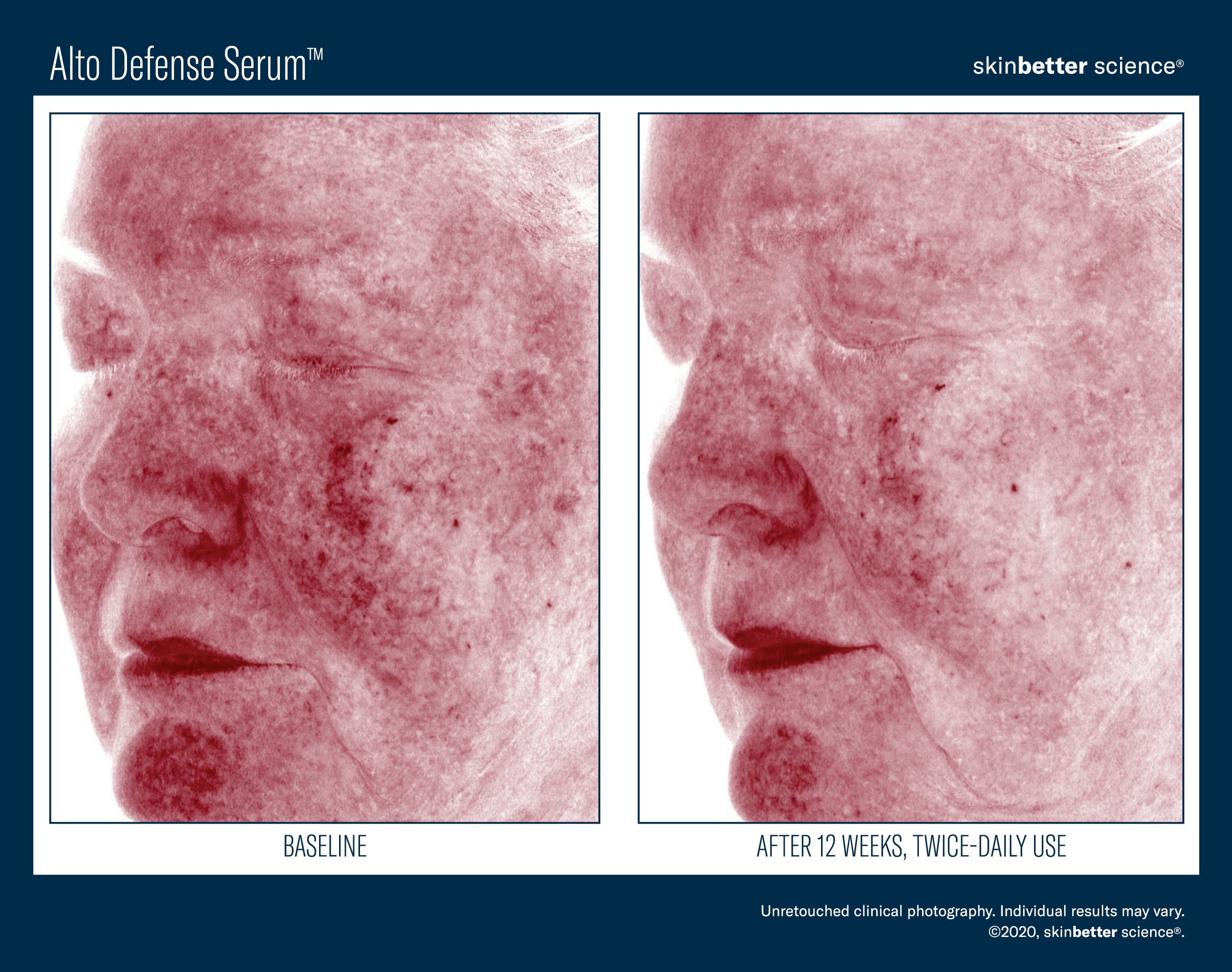 SkinBetter Science Alto Defense Serum (1 oz)