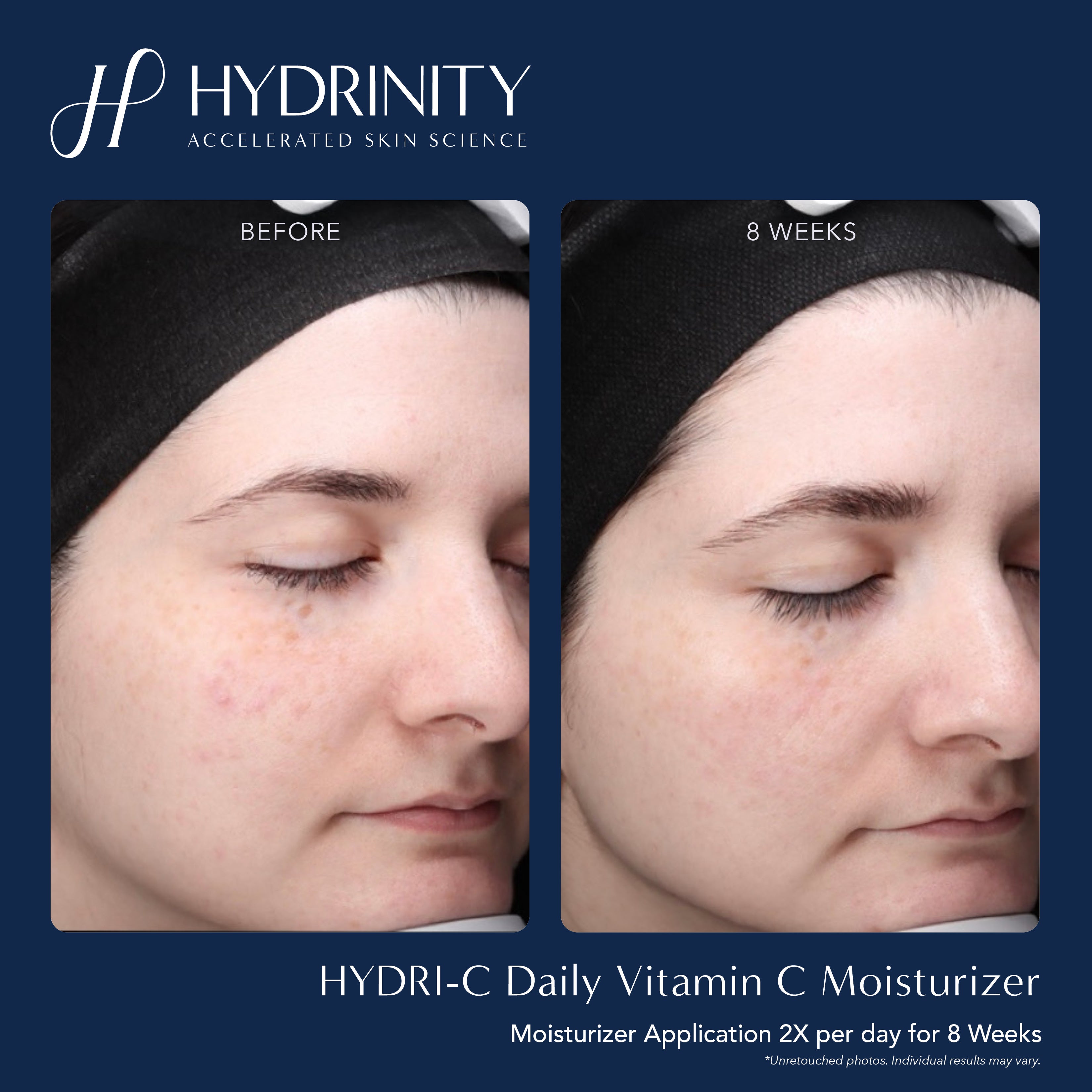 Hydrinity HYDRI-C Daily Vitamin C Moisturizer (1.7 oz)