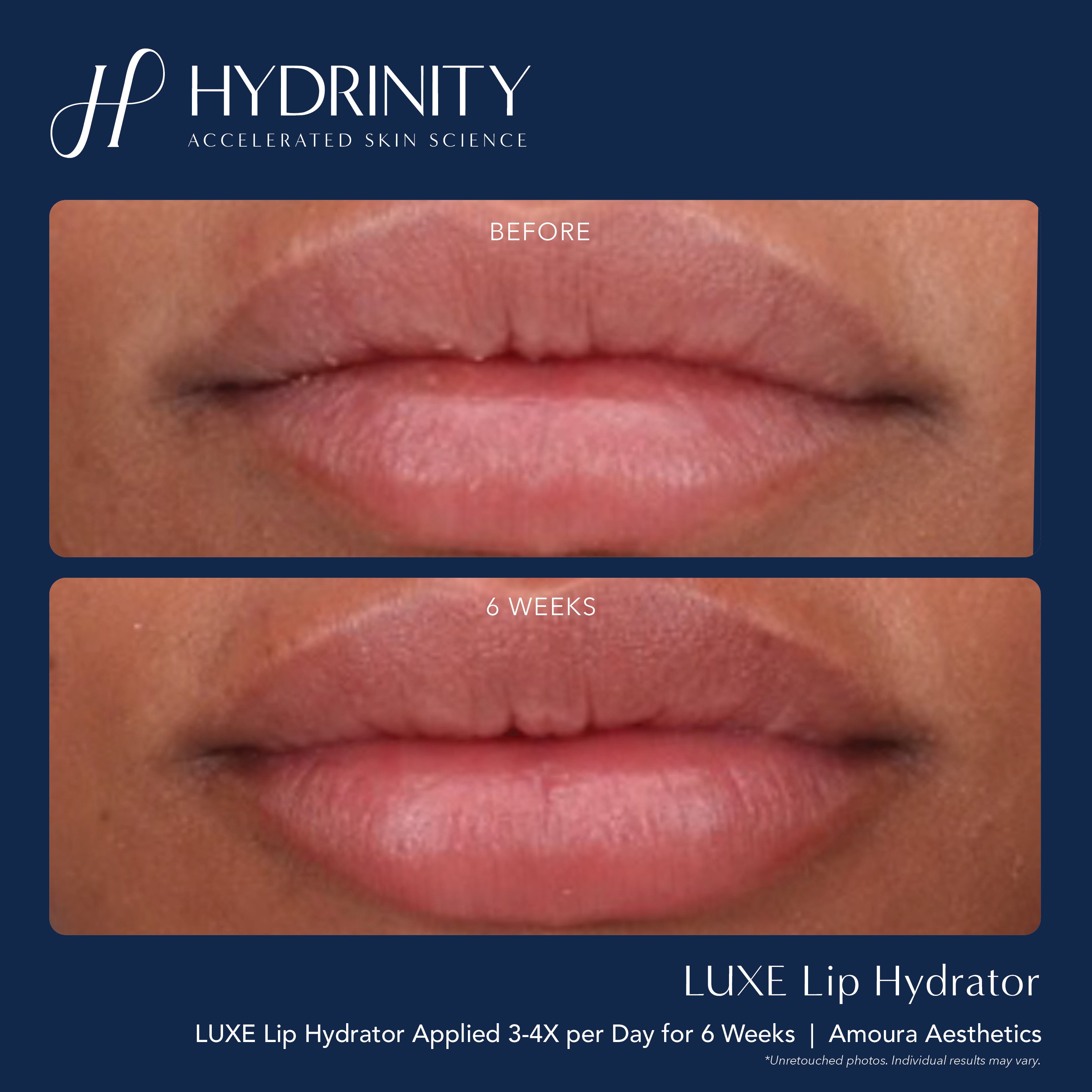Hydrinity LUXE Lip Hydrator (0.34 oz)