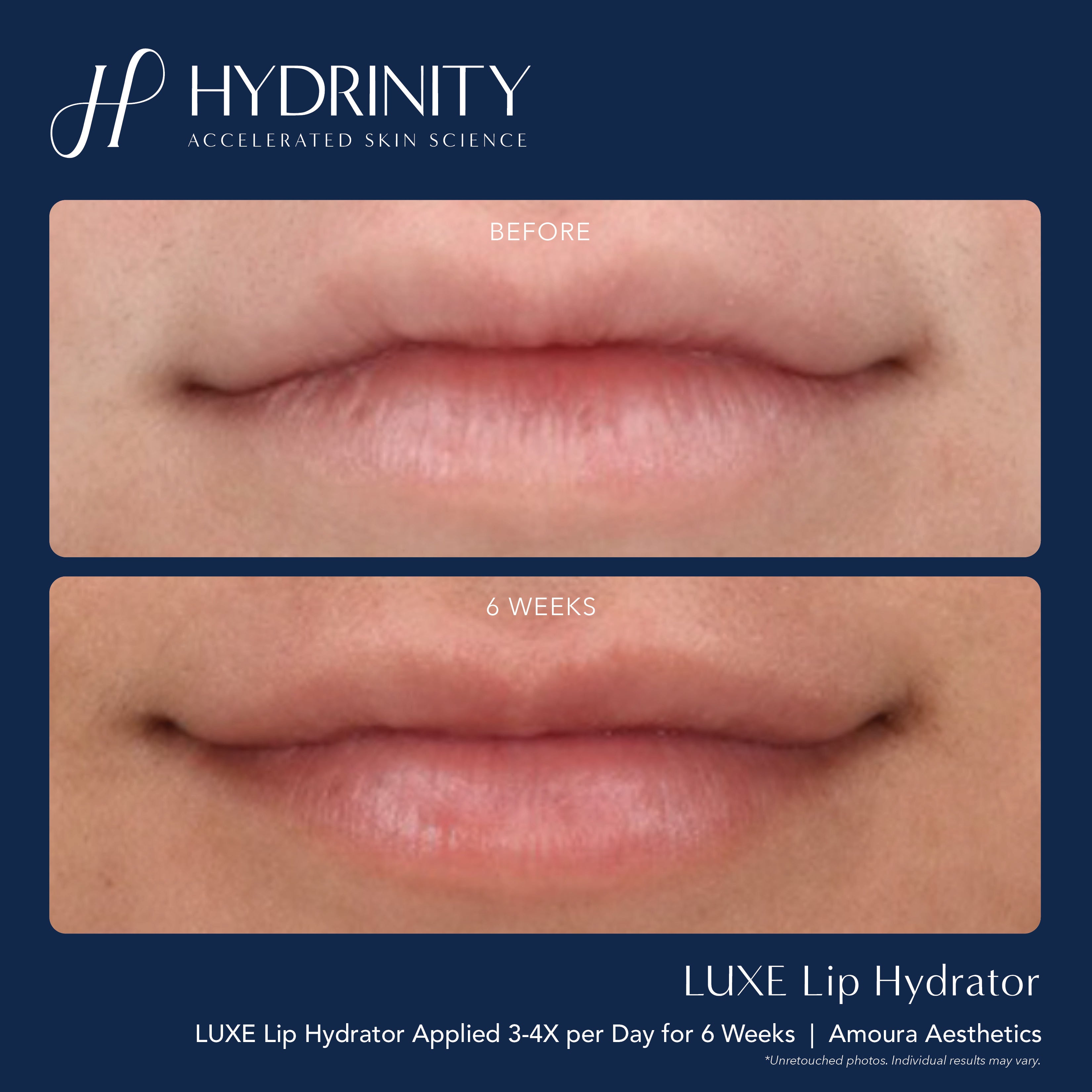Hydrinity LUXE Lip Hydrator (0.34 oz)