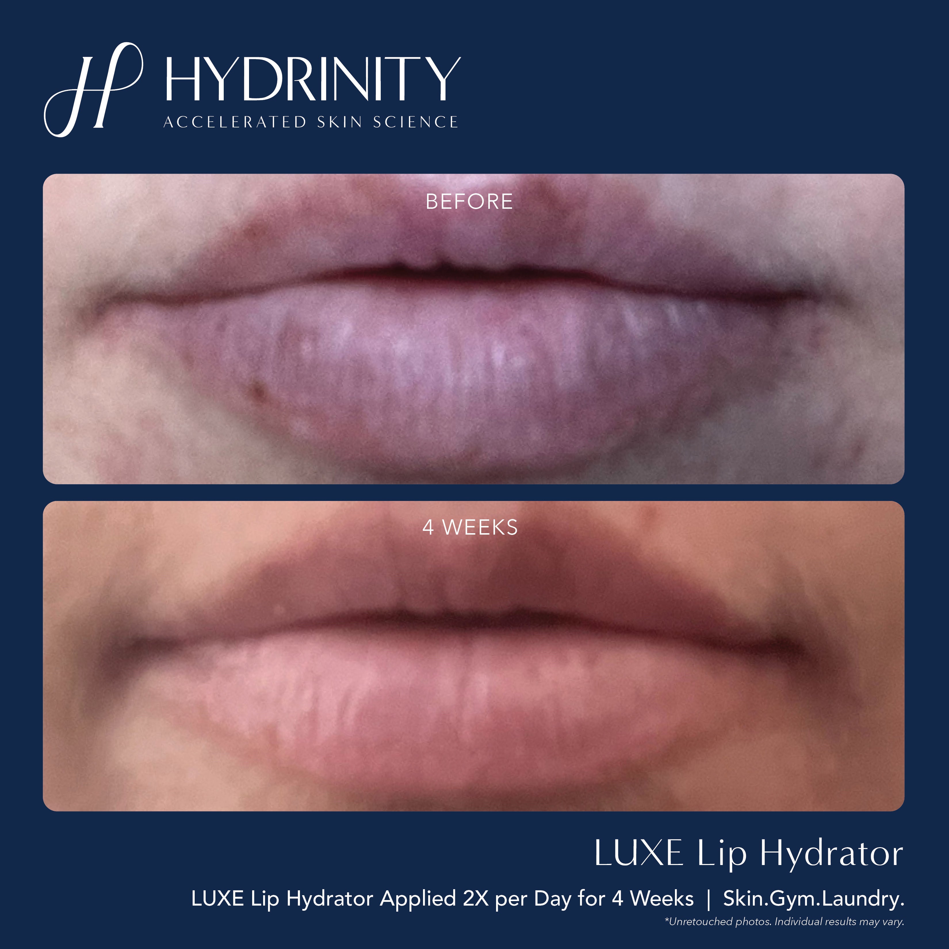 Hydrinity LUXE Lip Hydrator (0.34 oz)