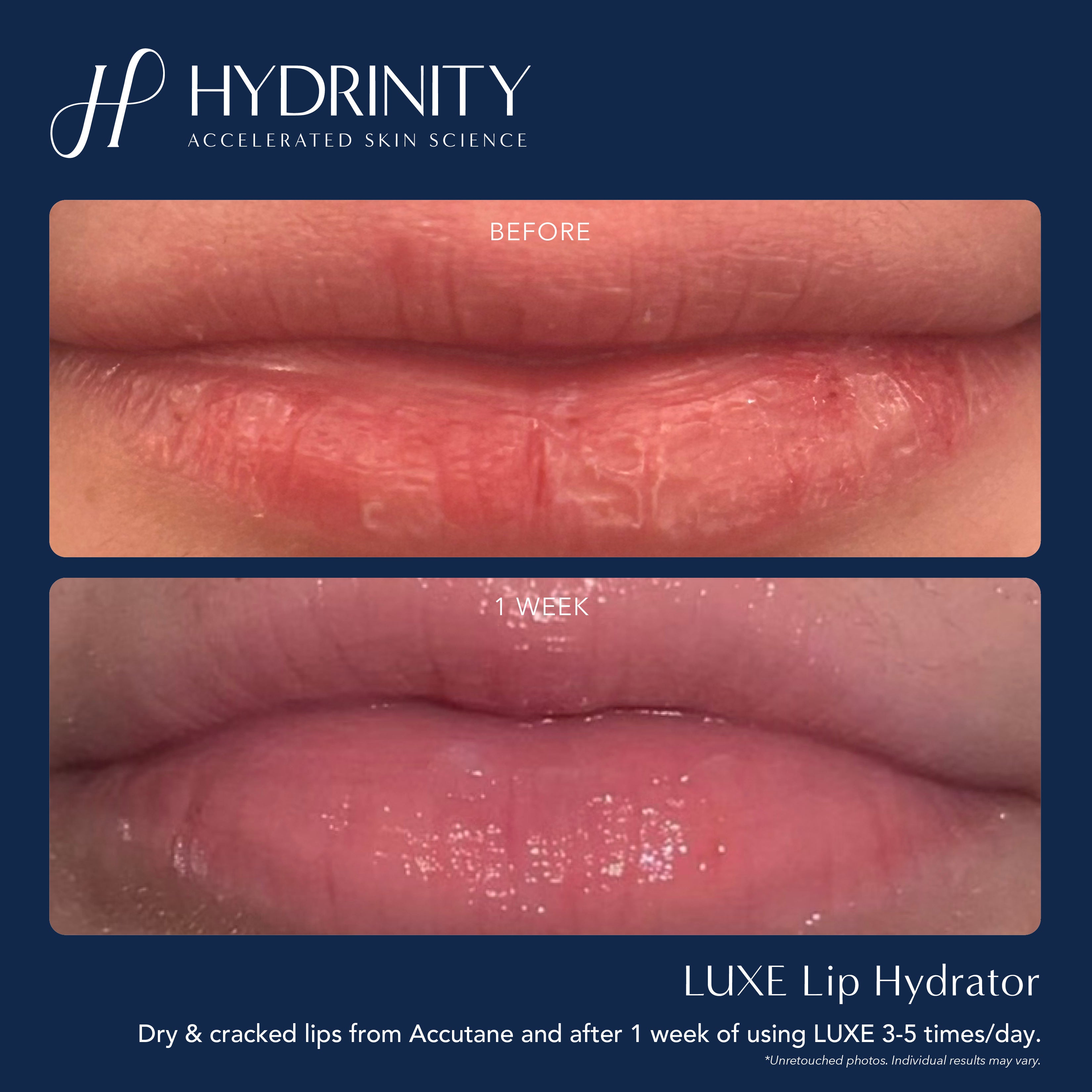 Hydrinity LUXE Lip Hydrator (0.34 oz)