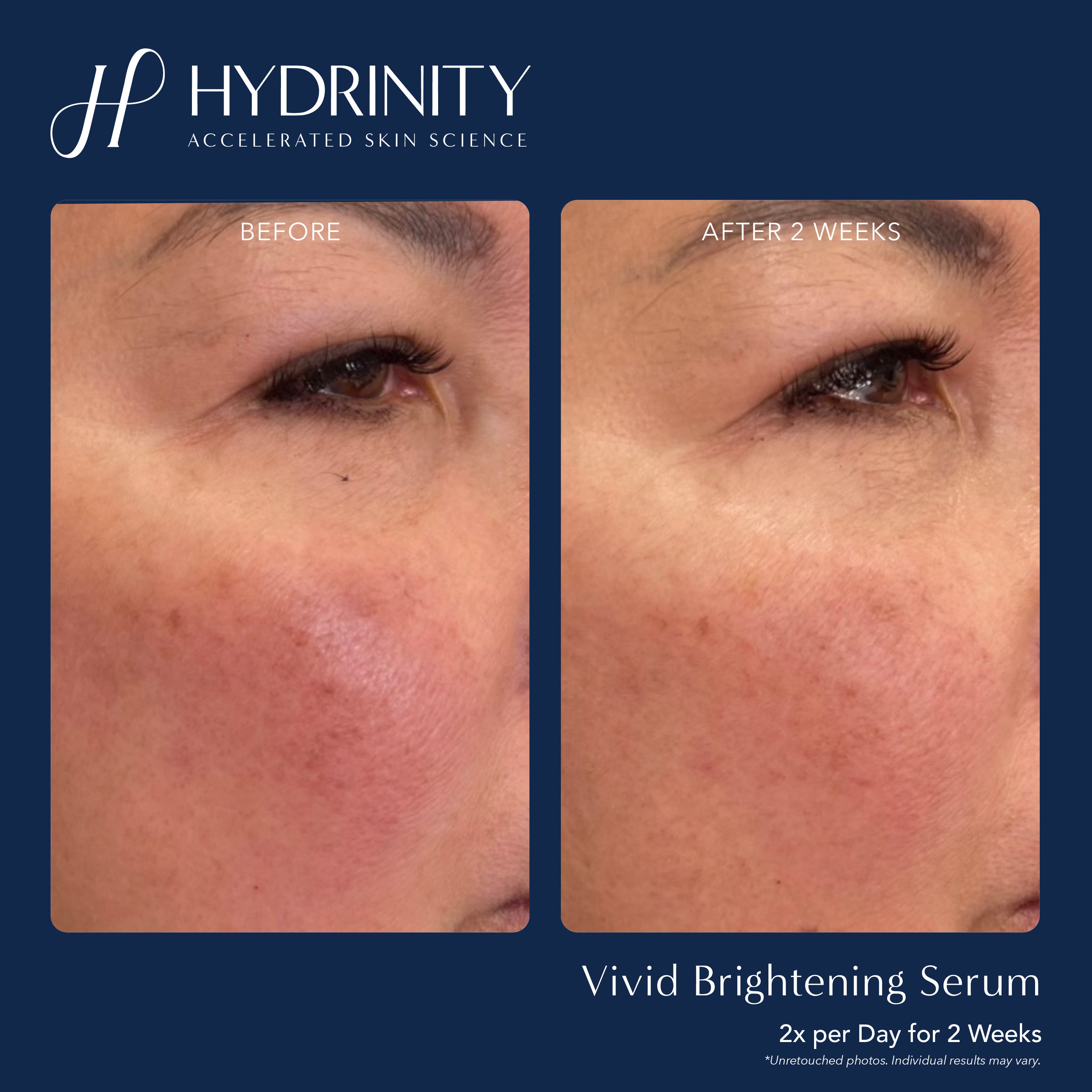 Hydrinity VIVID Brightening Serum (1 oz)