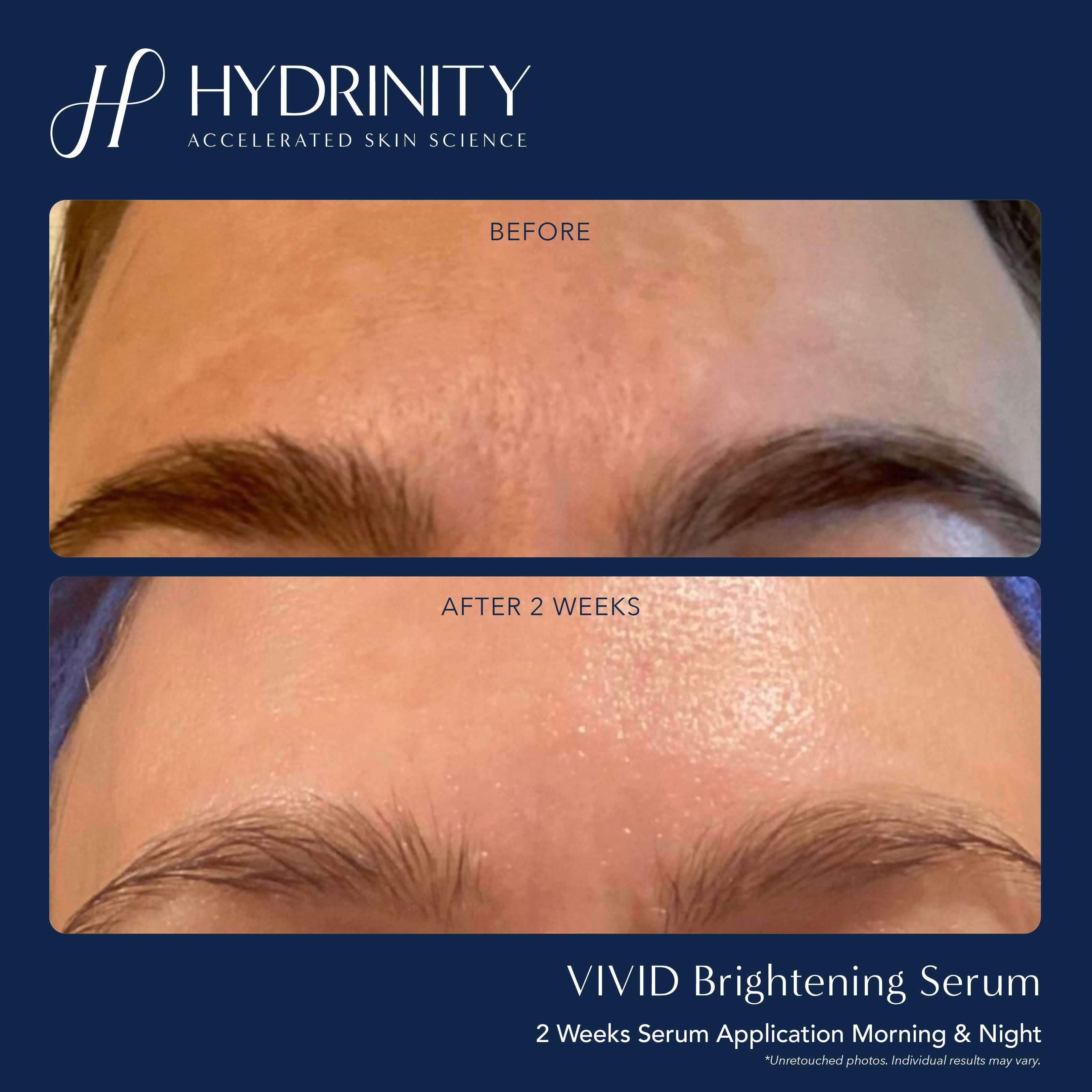 Hydrinity VIVID Brightening Serum (1 oz)