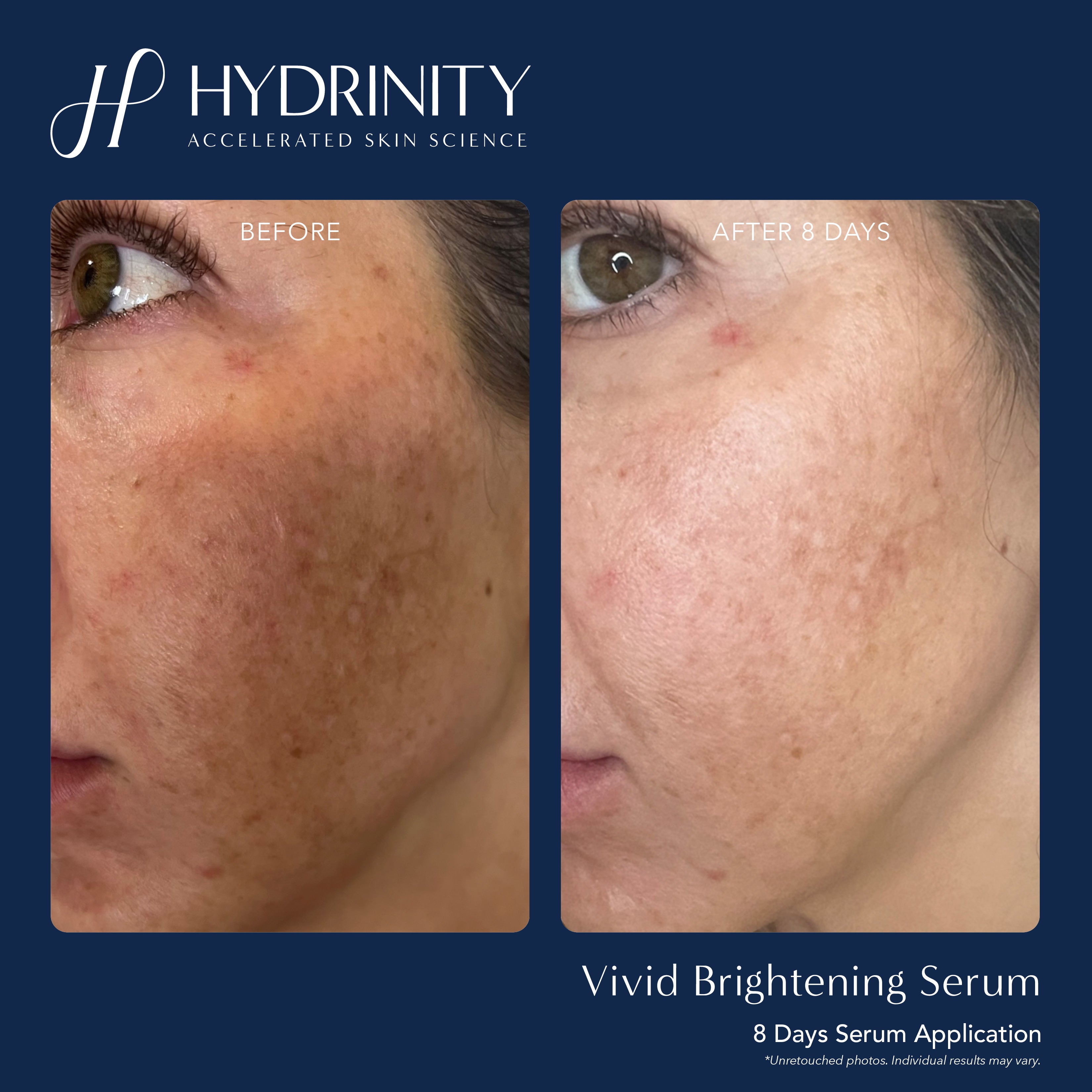 Hydrinity VIVID Brightening Serum (1 oz)