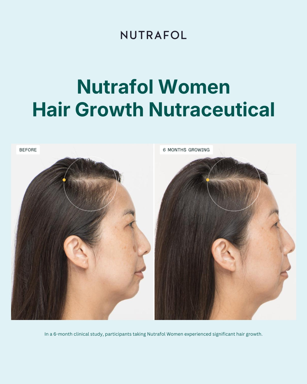 Nutrafol Women Advanced Formula Hair Growth Pack