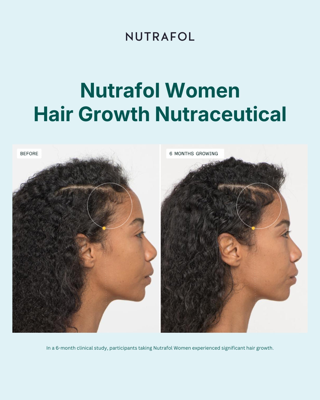 Nutrafol Women Advanced Formula Hair Growth Nutraceutical (120 Capsules)