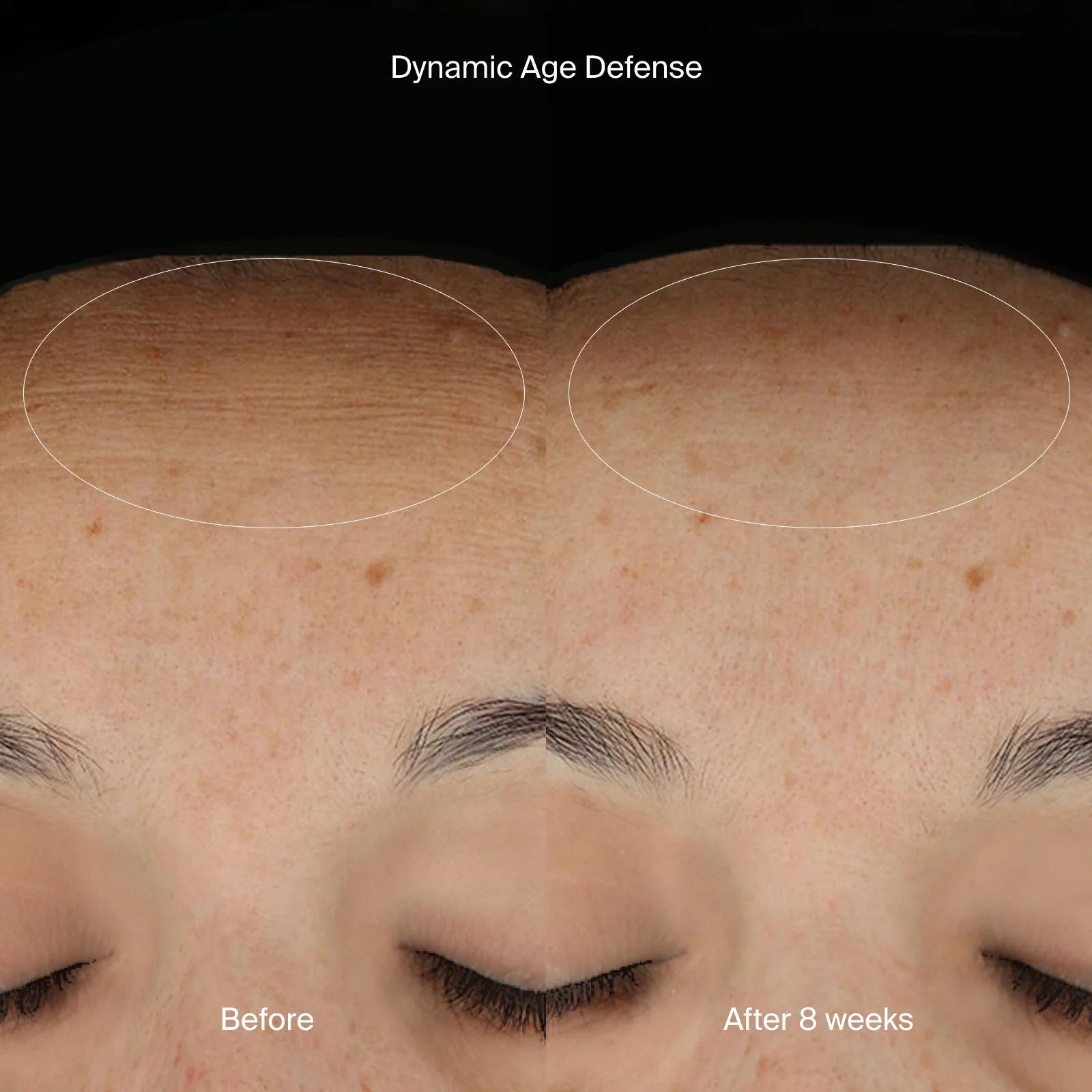 Pavise Core Refill System