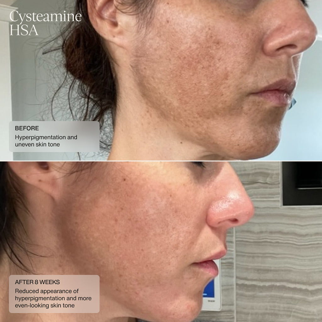 Senté Pigment & Tone Correcting Mask Cysteamine HSA (1.69 oz) & Dermal Repair Cream (0.5 oz) Duo