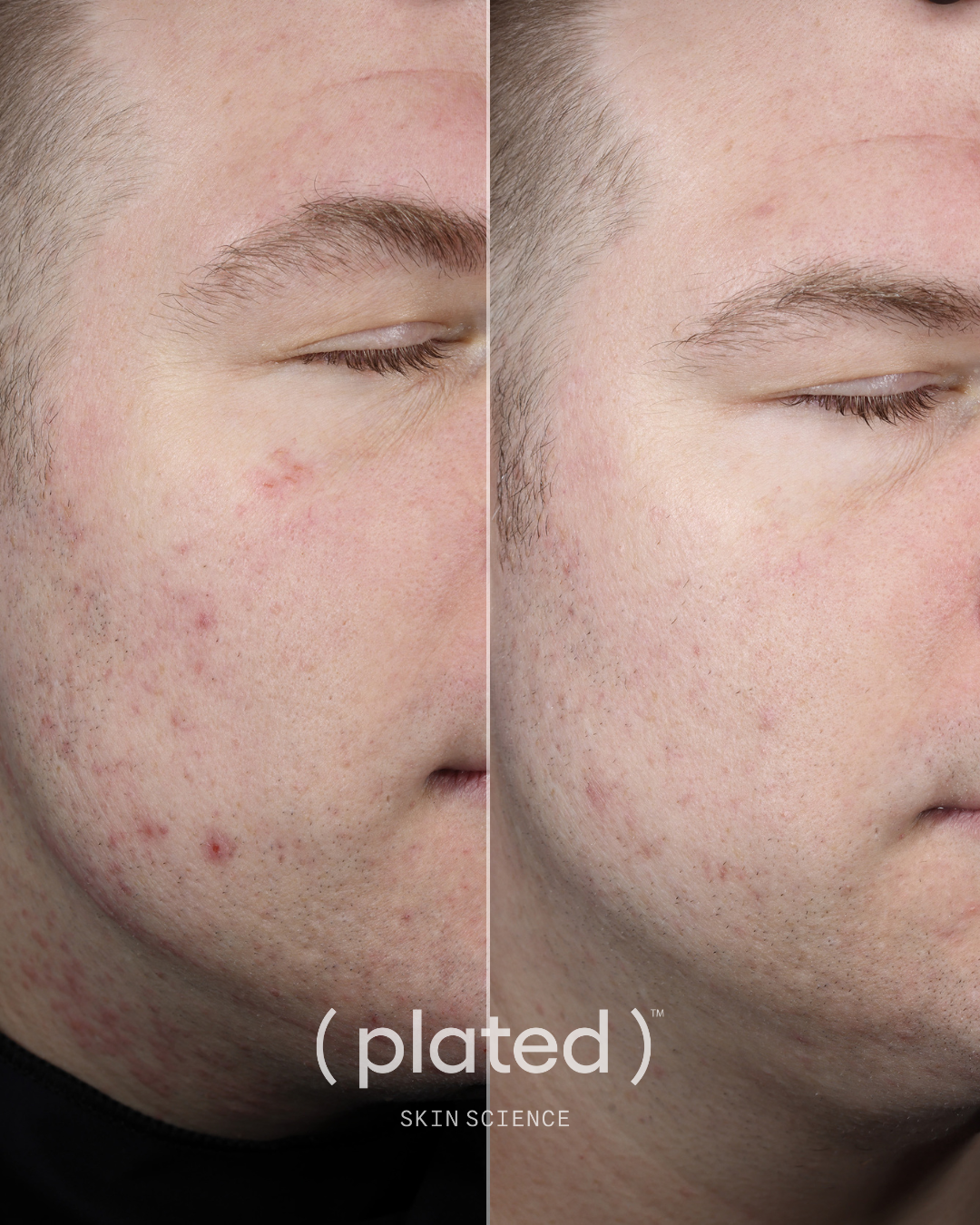 Plated Skin Science DAILY Serum (1 oz)