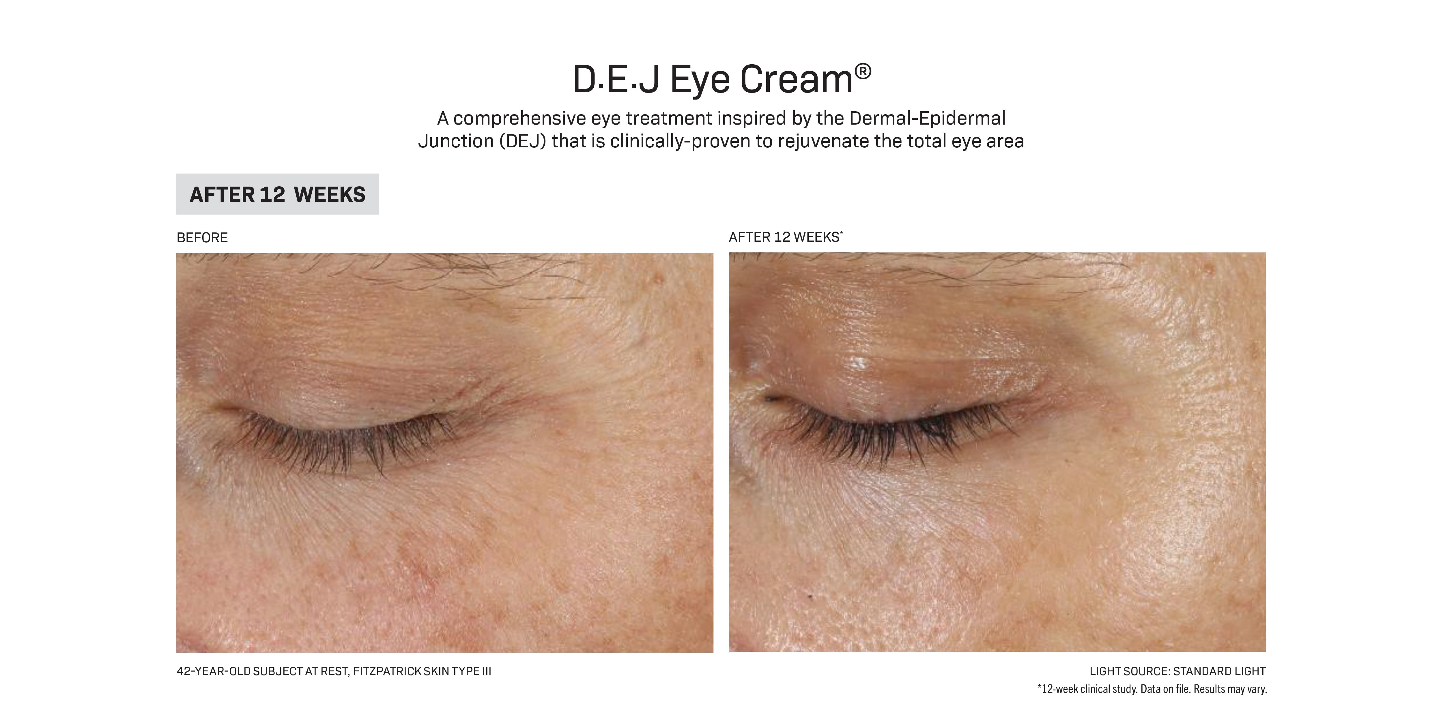 Revision Skincare D·E·J Eye Cream® (0.5 oz)