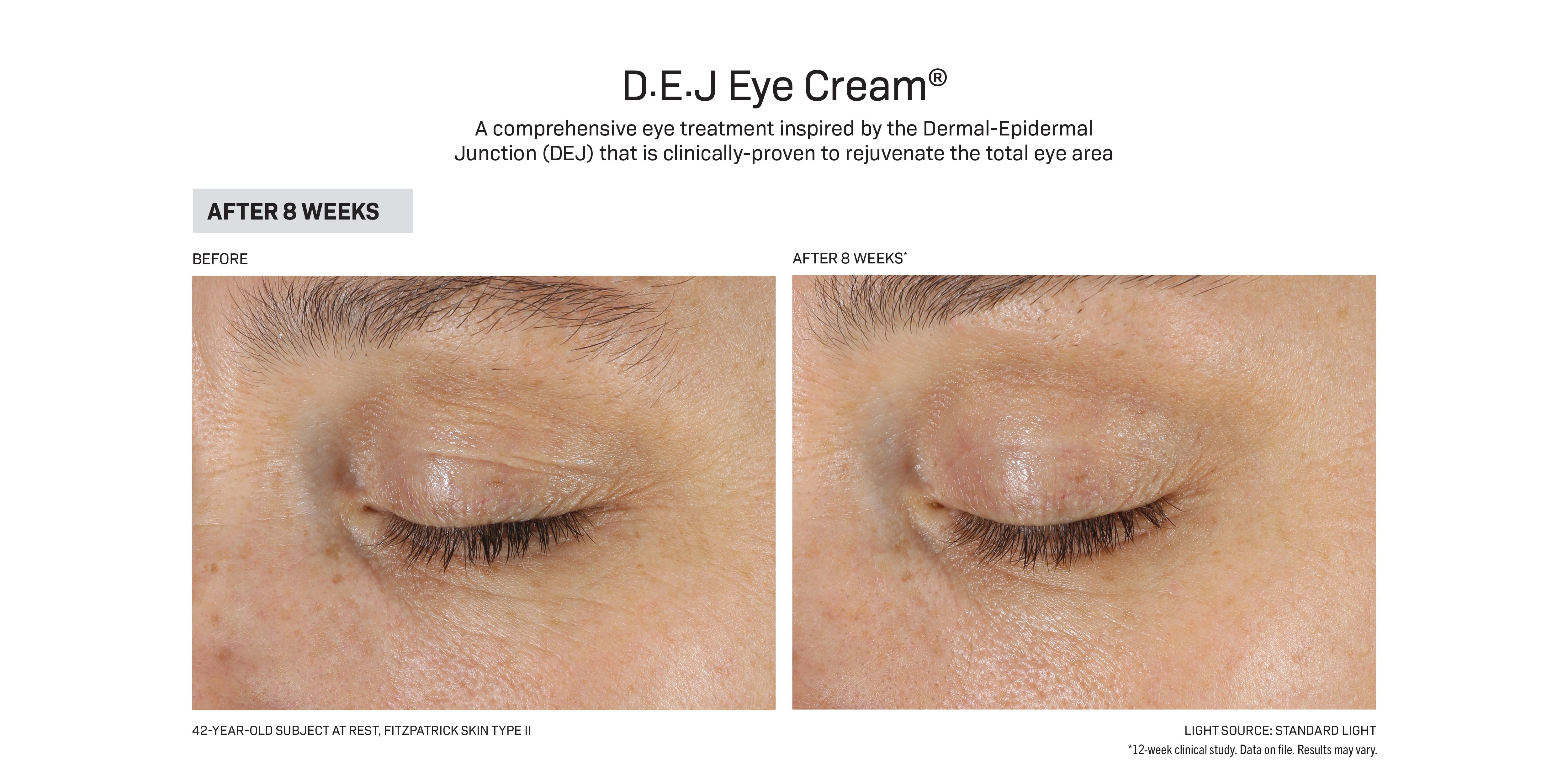 Revision Skincare D·E·J Eye Cream® (0.5 oz Pump)