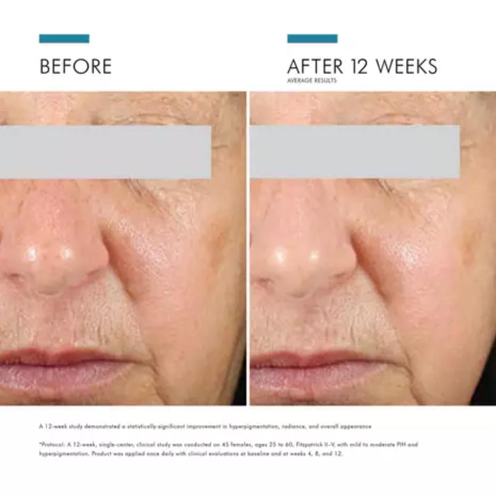 SkinCeuticals Daily Brightening UV Defense SPF 30 (1 oz)