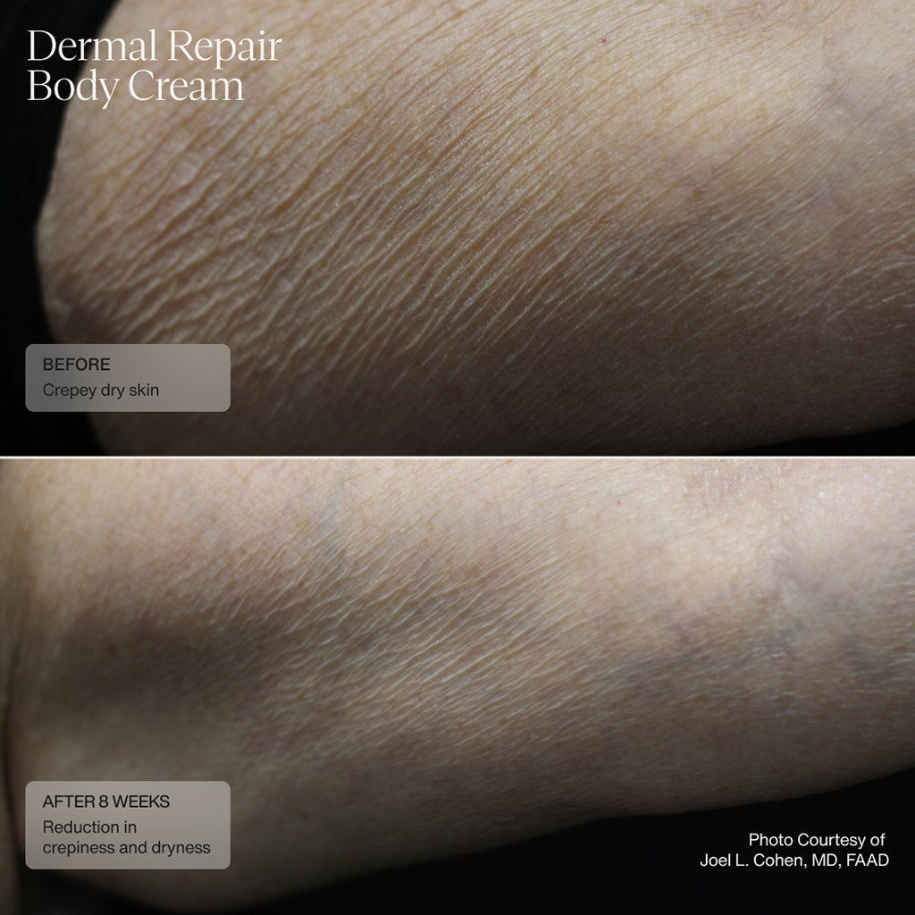 Senté Dermal Repair Body Cream (6 oz)