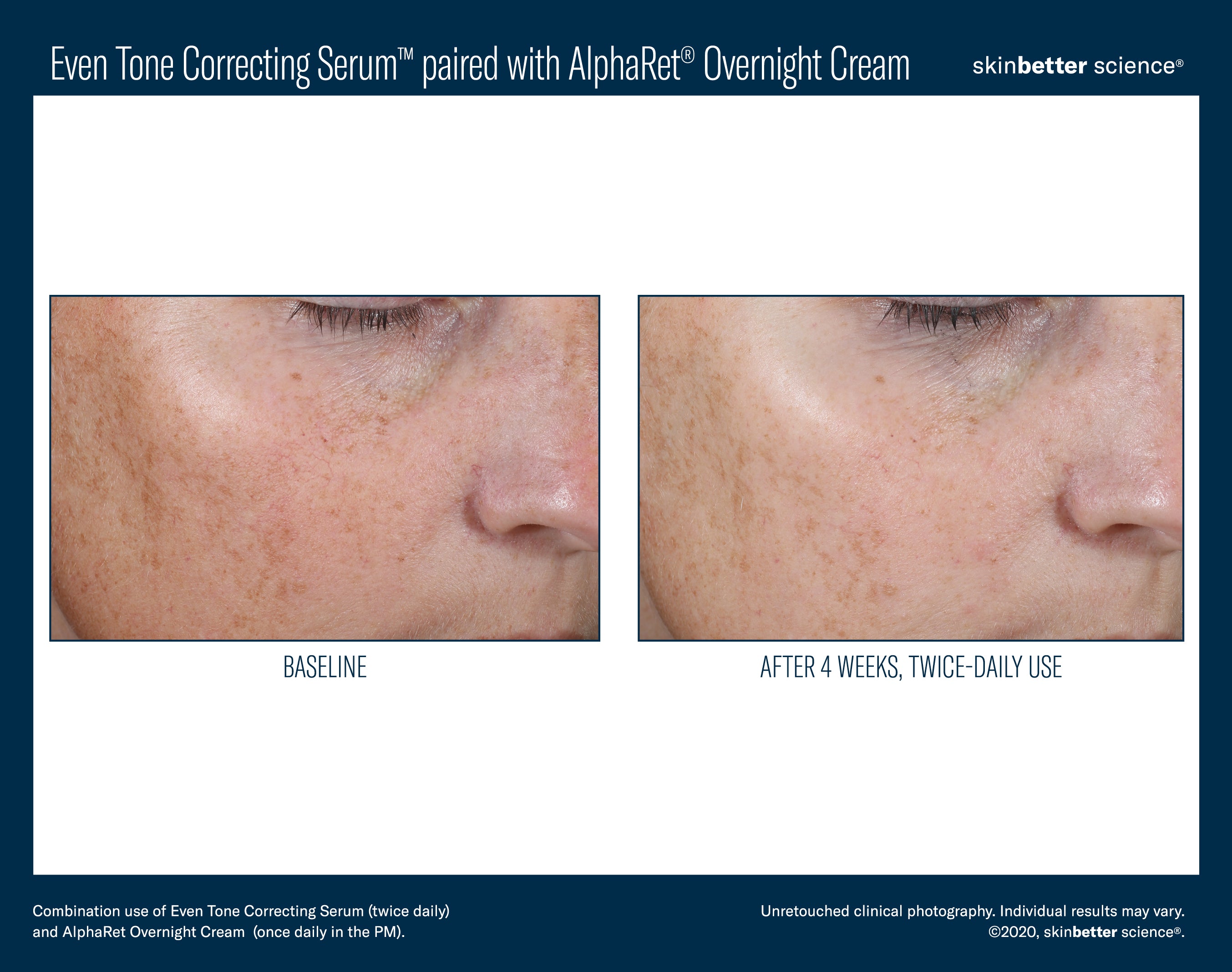 SkinBetter Science Even Tone Correcting Serum (1.69 oz)