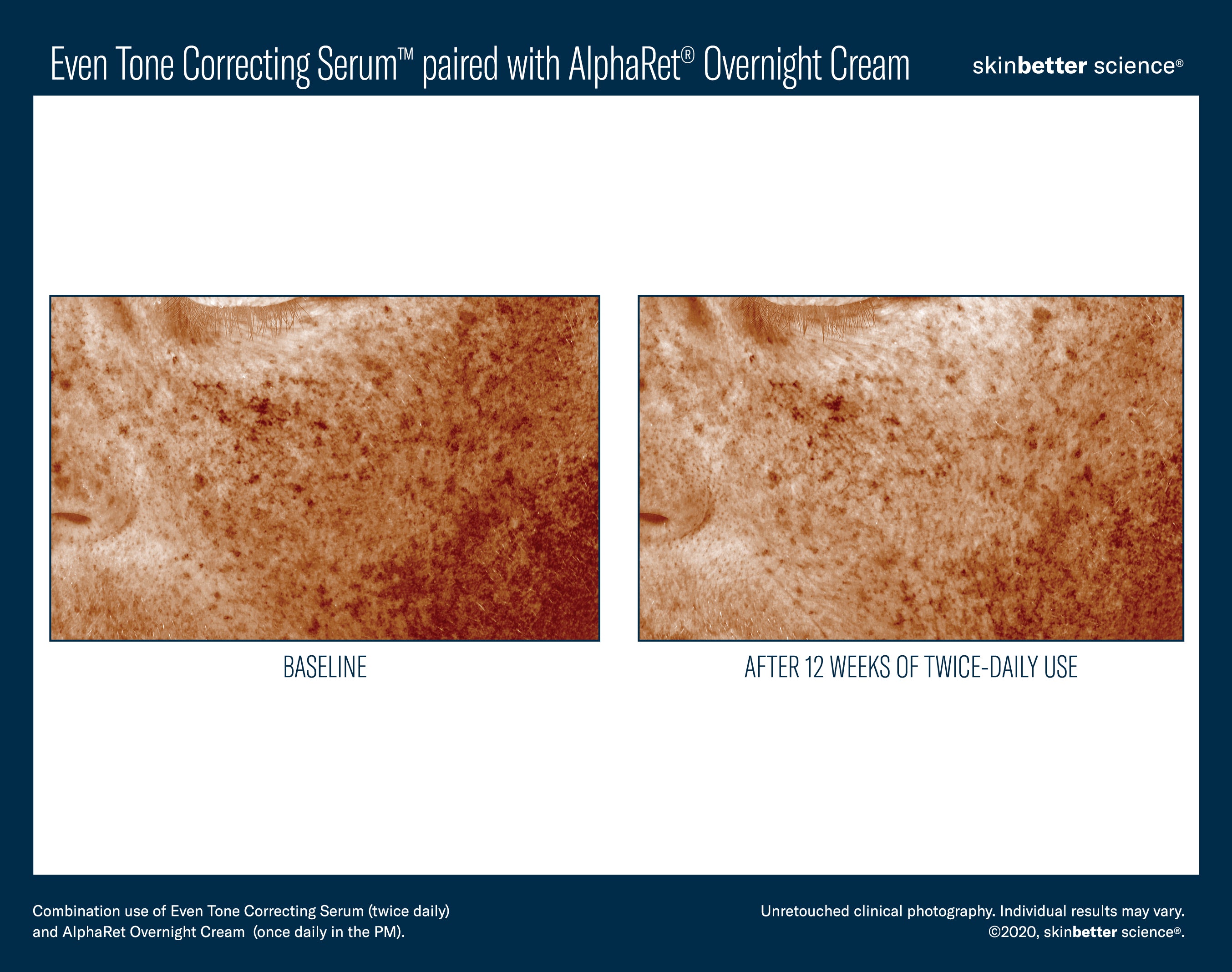 SkinBetter Science Even Tone Correcting Serum (1.69 oz)