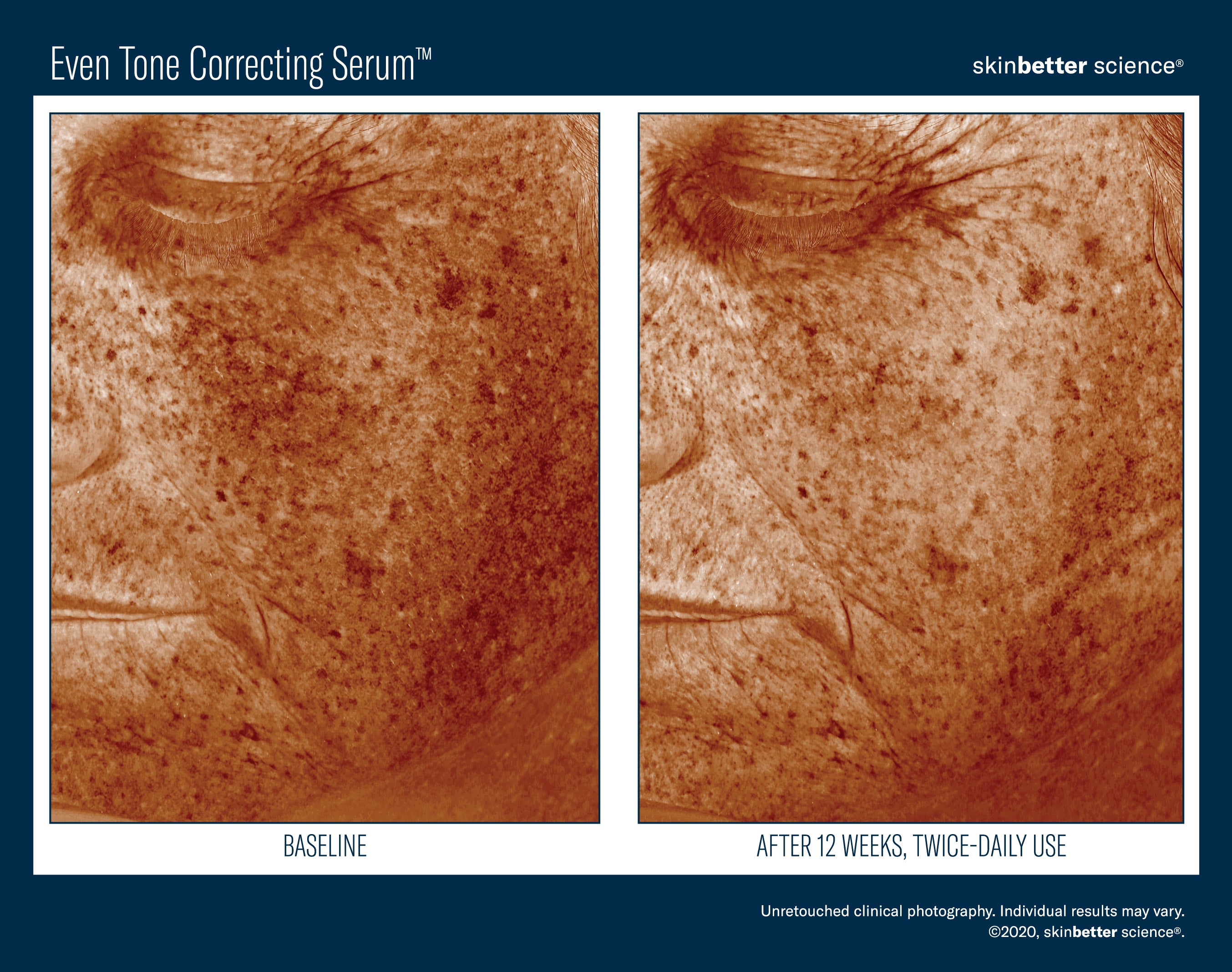 SkinBetter Science Even Tone Correcting Serum (1.69 oz)