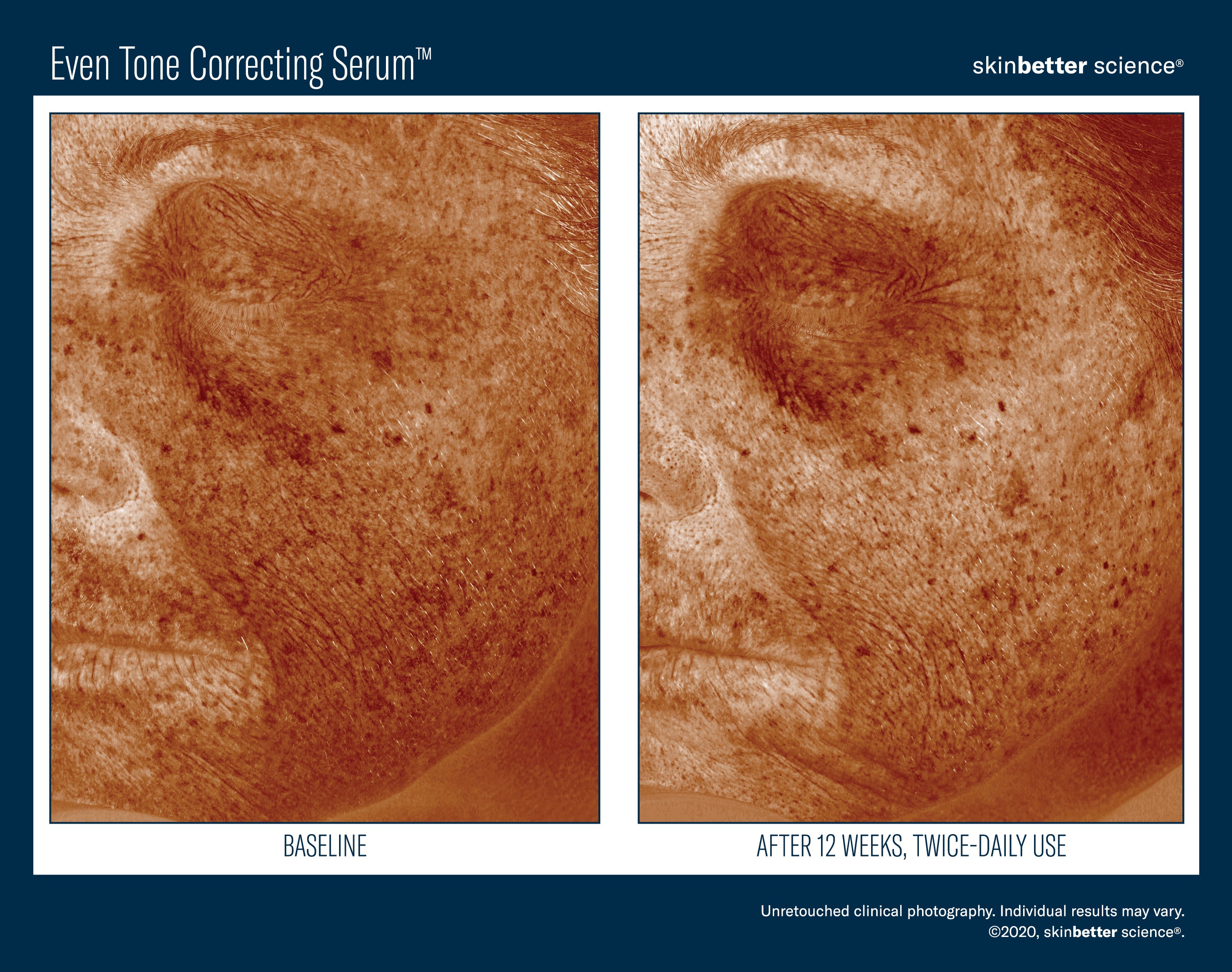 SkinBetter Science Even Tone Correcting Serum (1.69 oz)