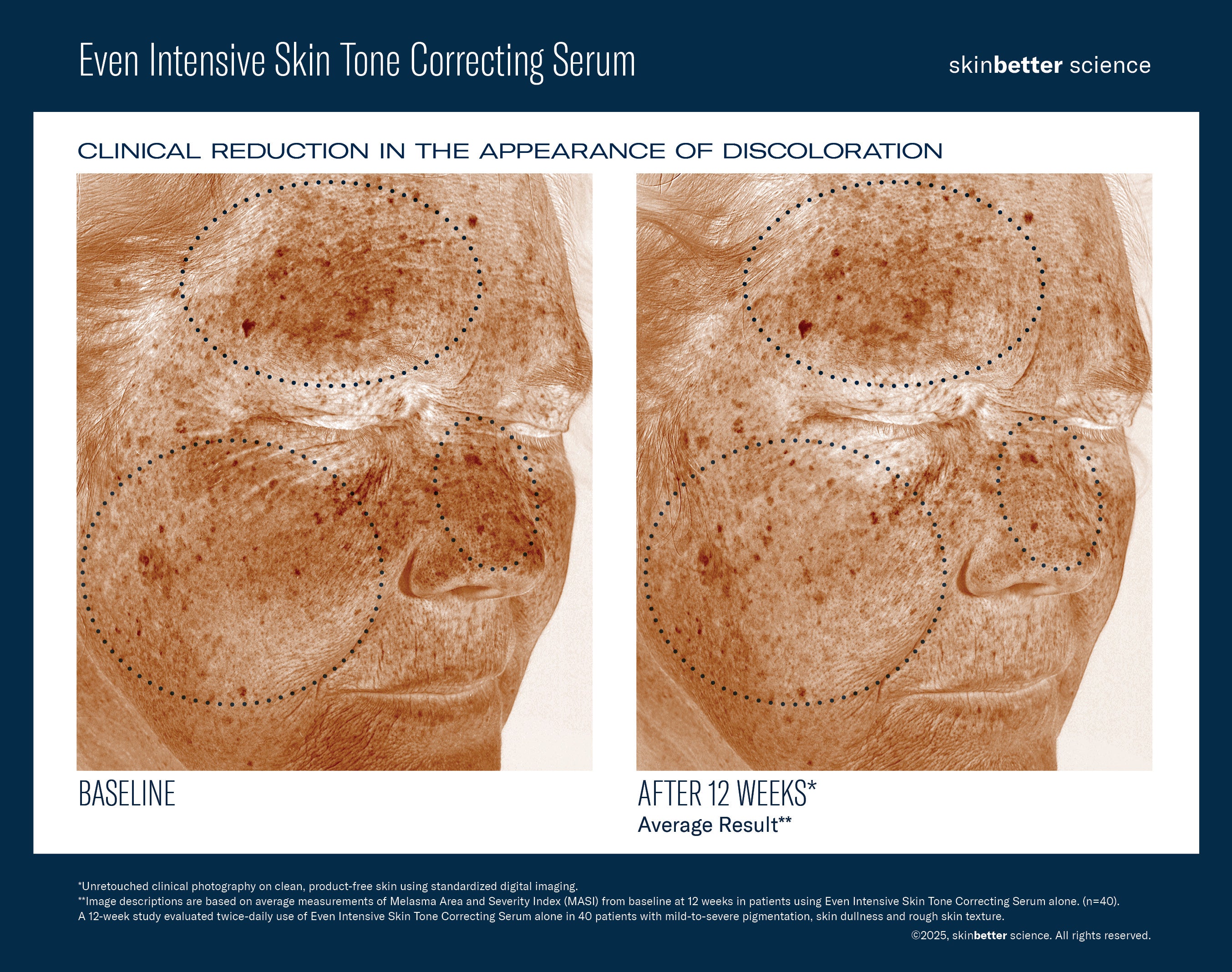 SkinBetter Science Even Intensive Skin Tone Correcting Serum (1.7 oz)