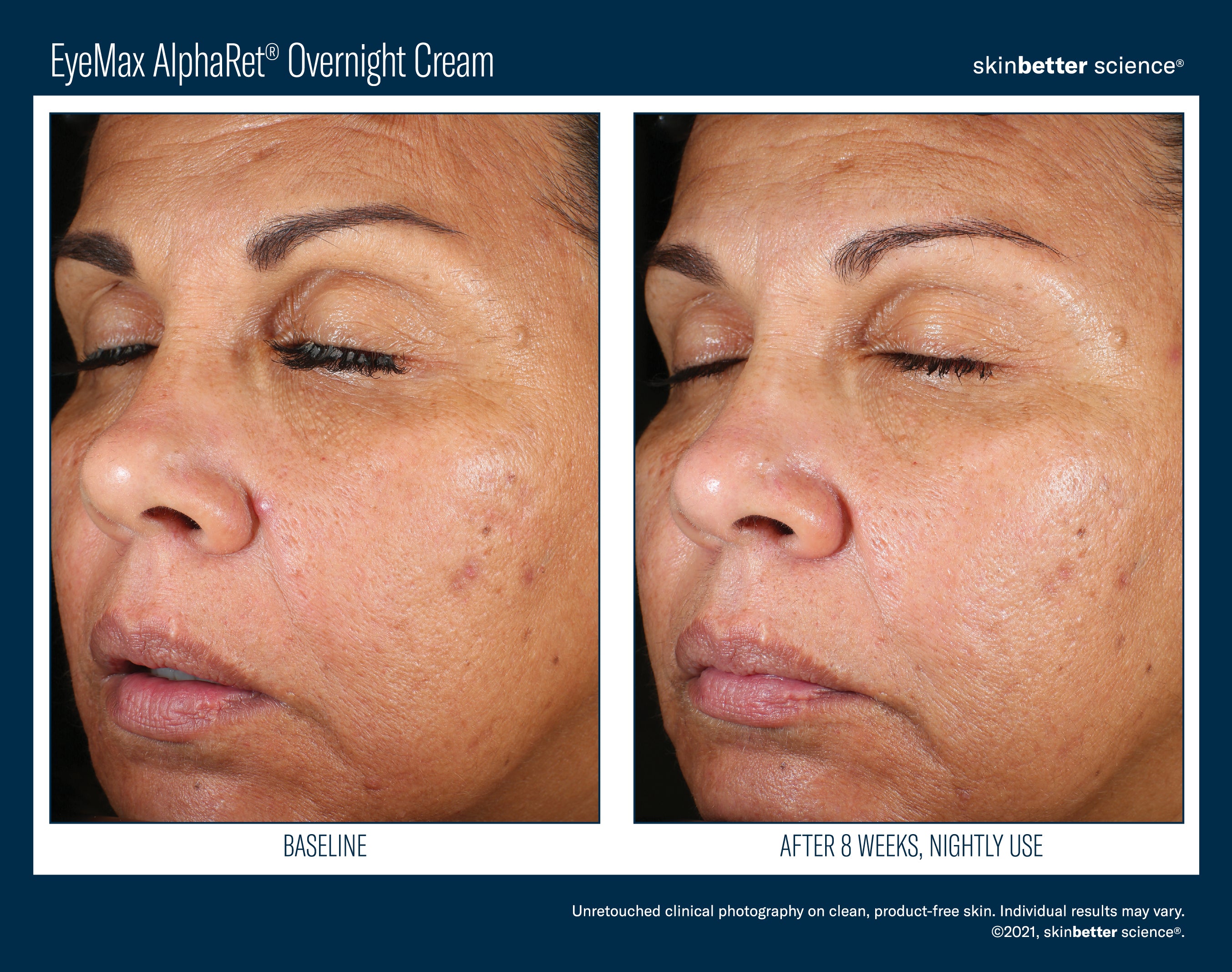 SkinBetter Science EyeMax AlphaRet Overnight Cream (0.5 oz)