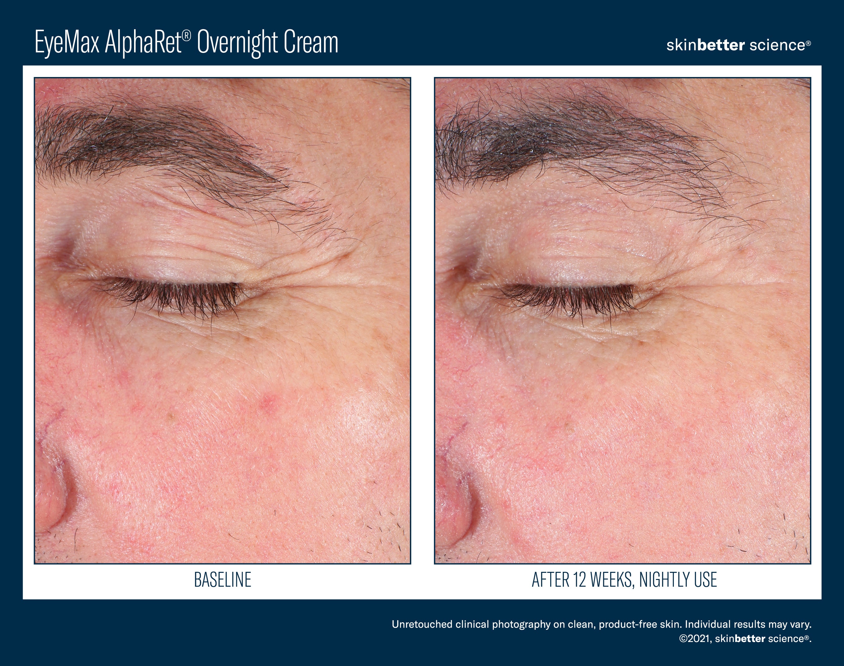 SkinBetter Science EyeMax AlphaRet Overnight Cream (0.5 oz)