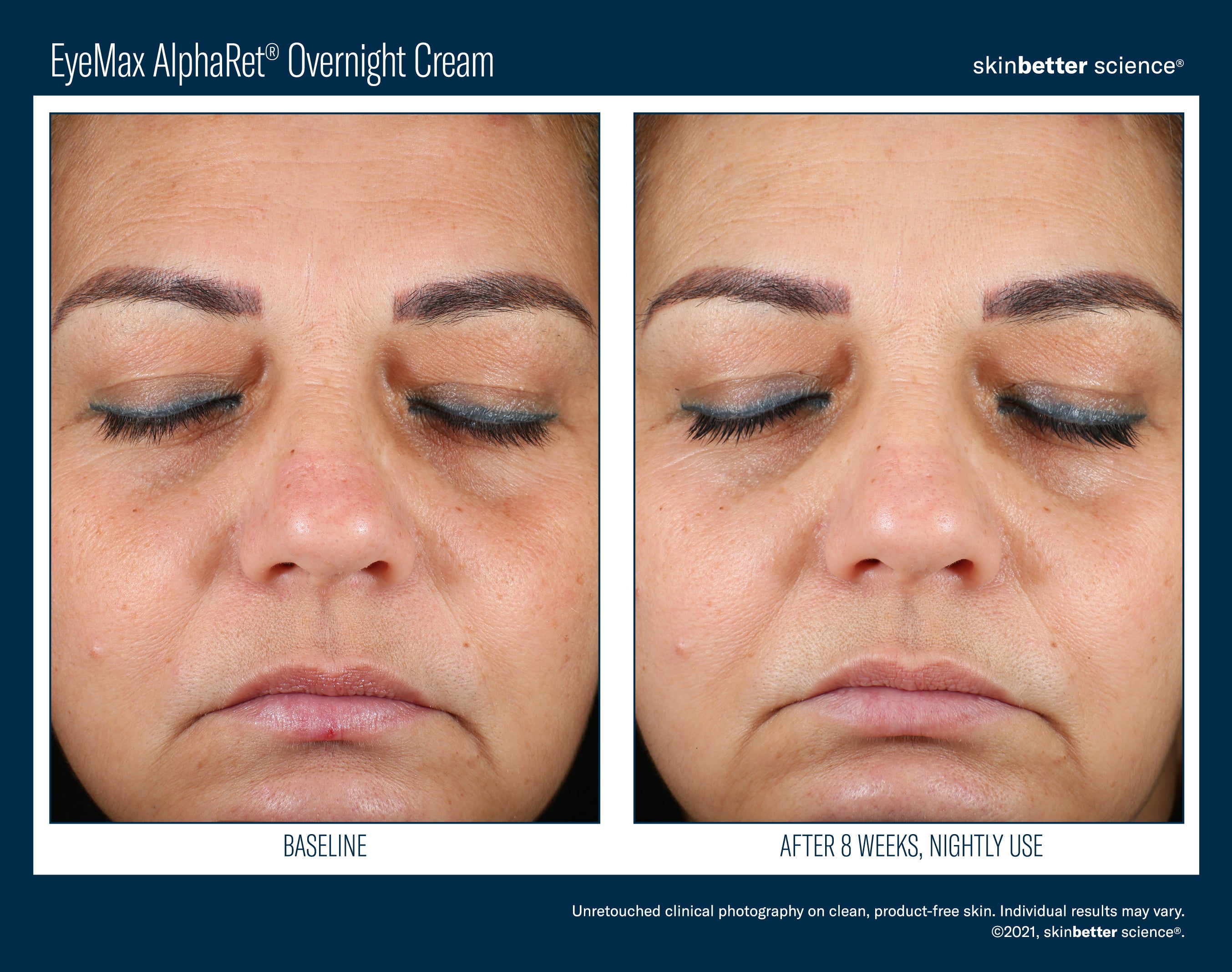 SkinBetter Science EyeMax AlphaRet Overnight Cream (0.5 oz)