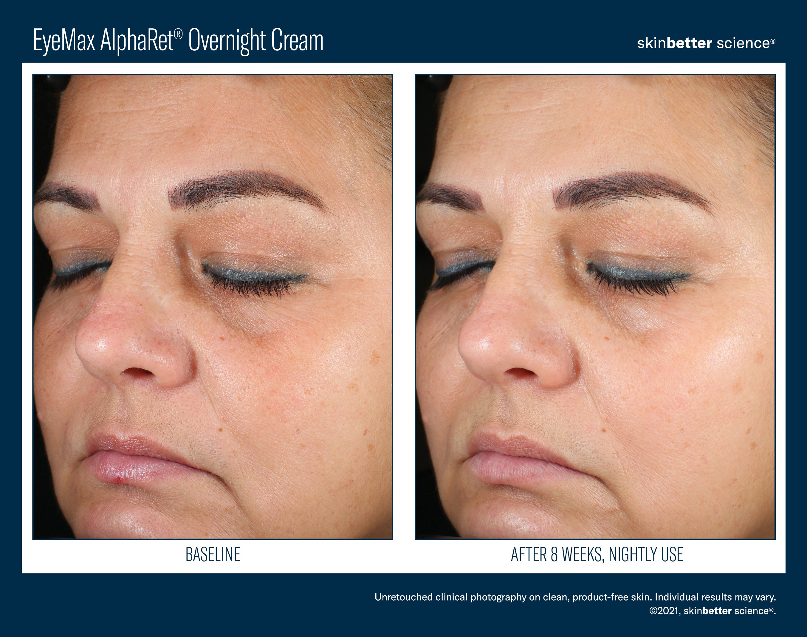 SkinBetter Science Travel Size EyeMax AlphaRet Overnight Cream (0.17 oz)